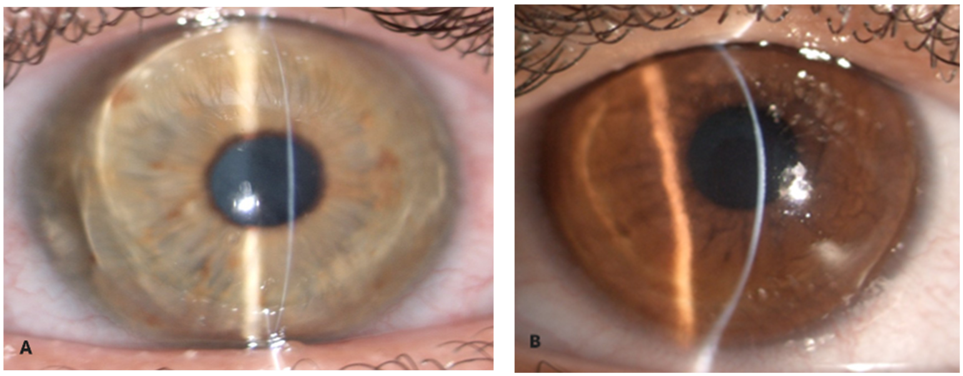 Diagnostics 15 01596 g001