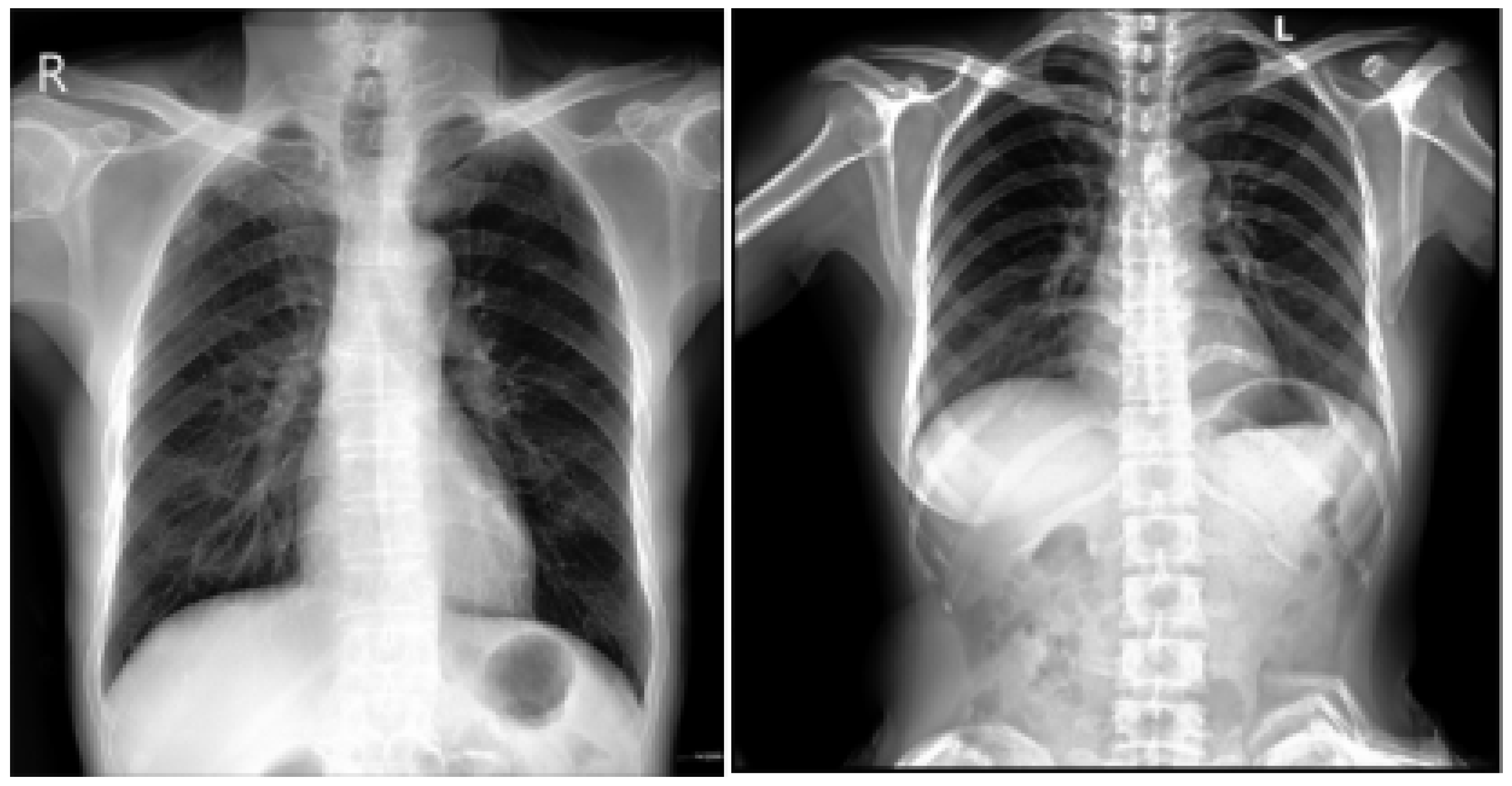 Diagnostics 15 01602 g005