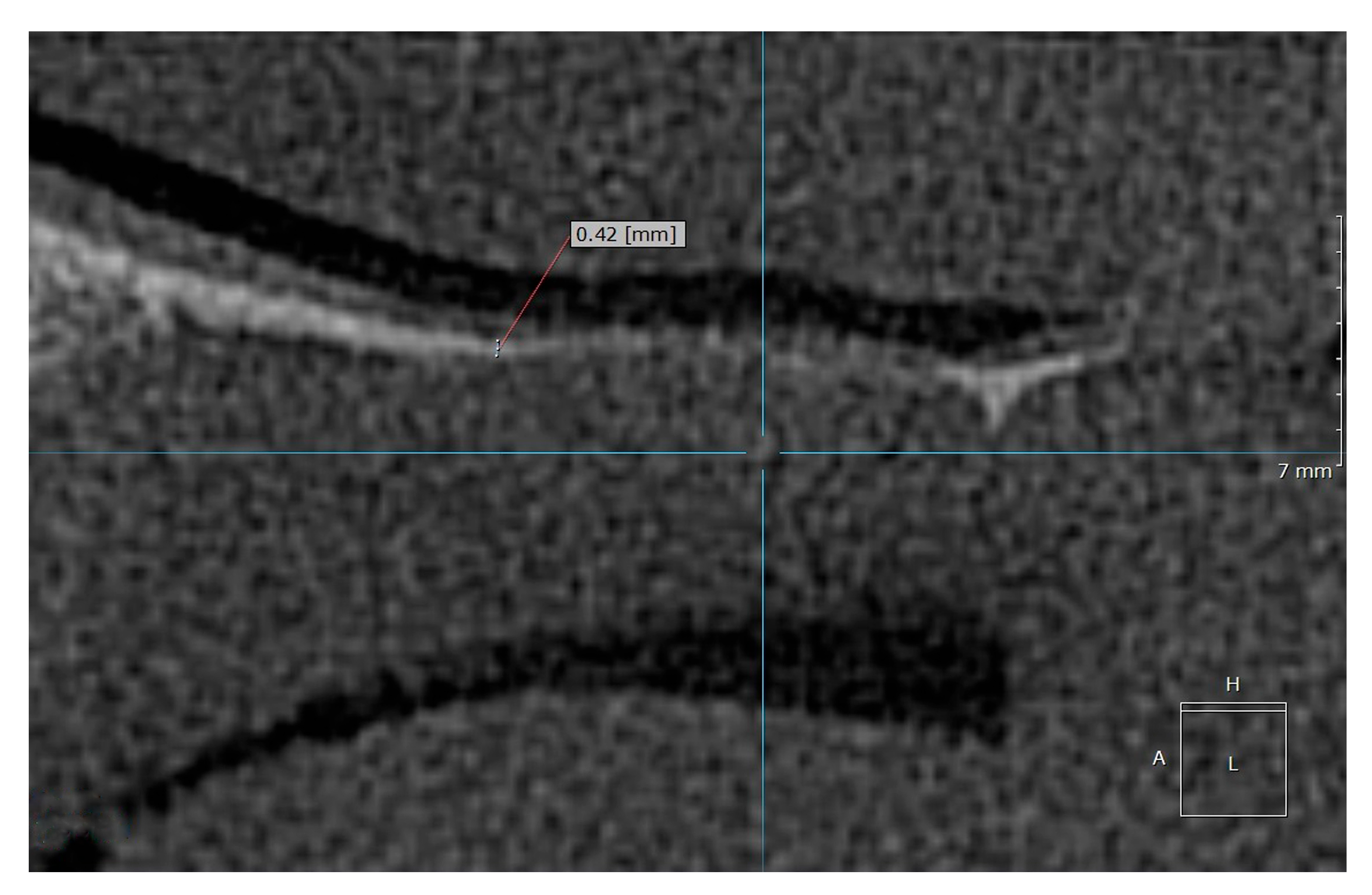 Diagnostics 15 01603 g004