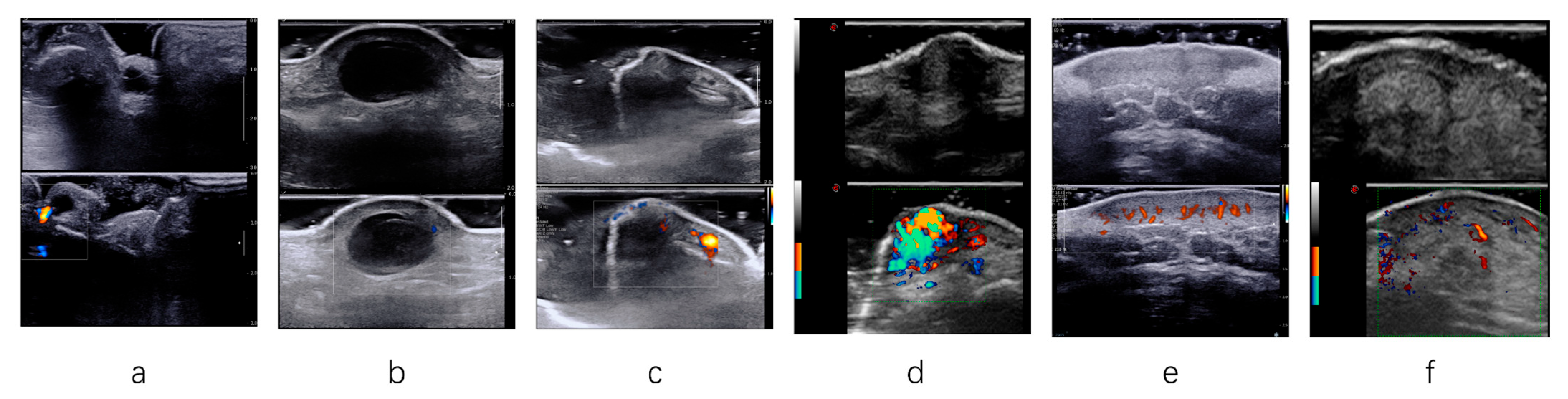 Diagnostics 15 01605 g003 Diagnostics 15 01605 g003