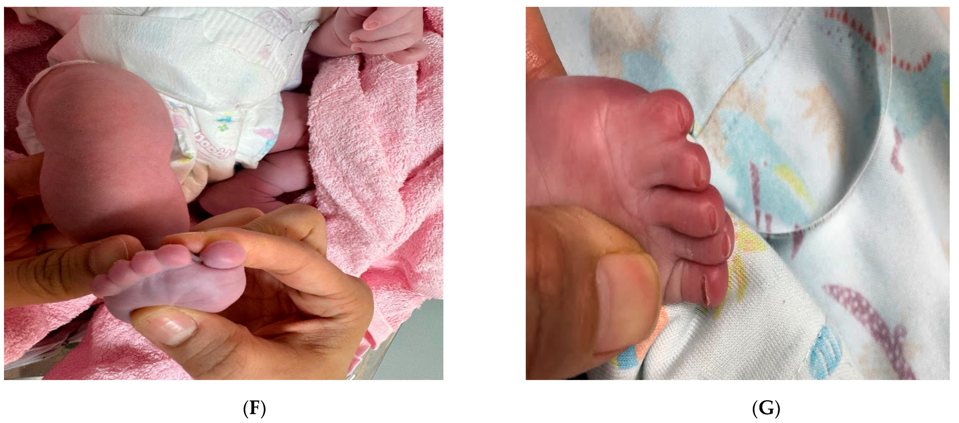 Diagnostics 15 01606 g001b Diagnostics 15 01606 g001b