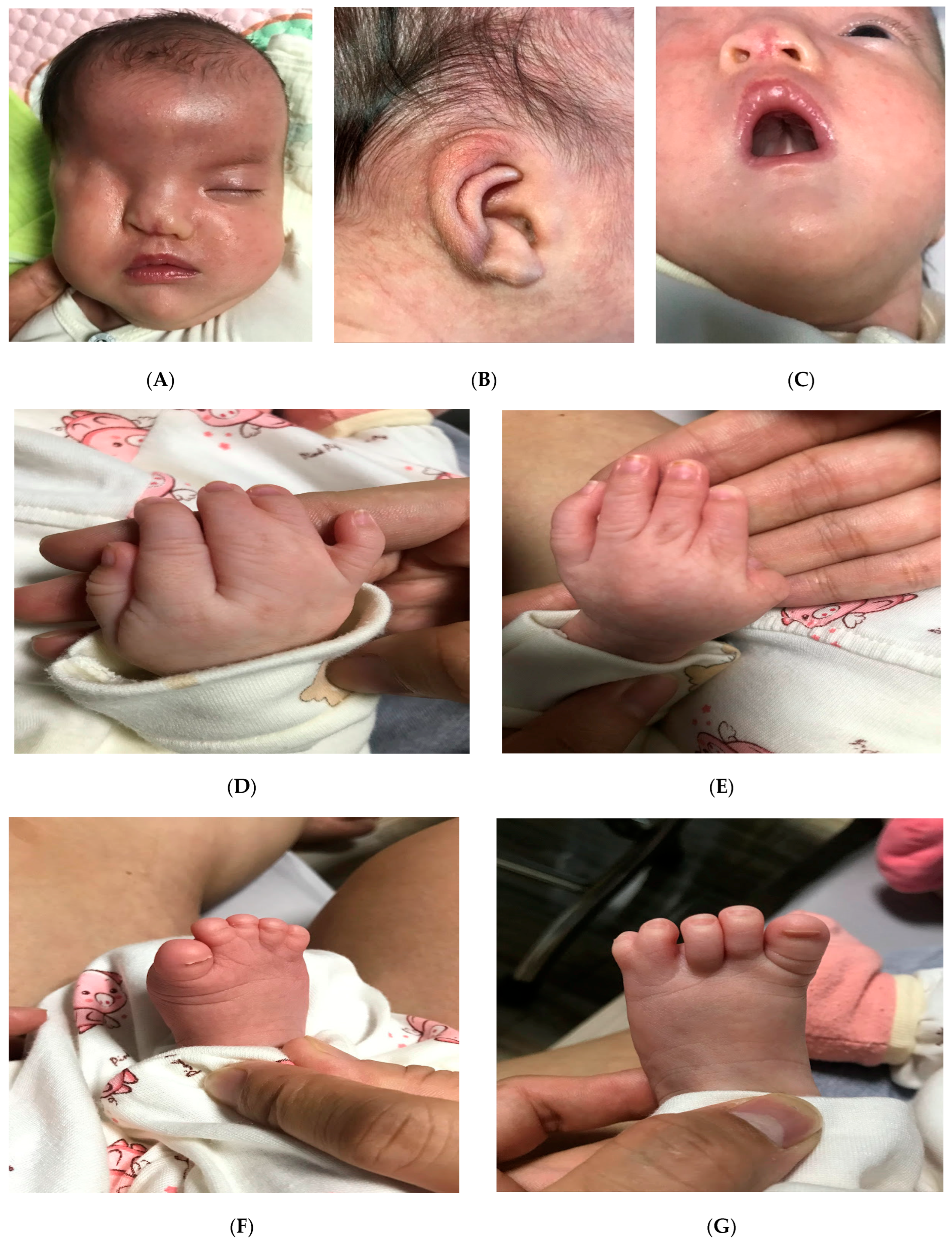 Diagnostics 15 01606 g002 Diagnostics 15 01606 g002