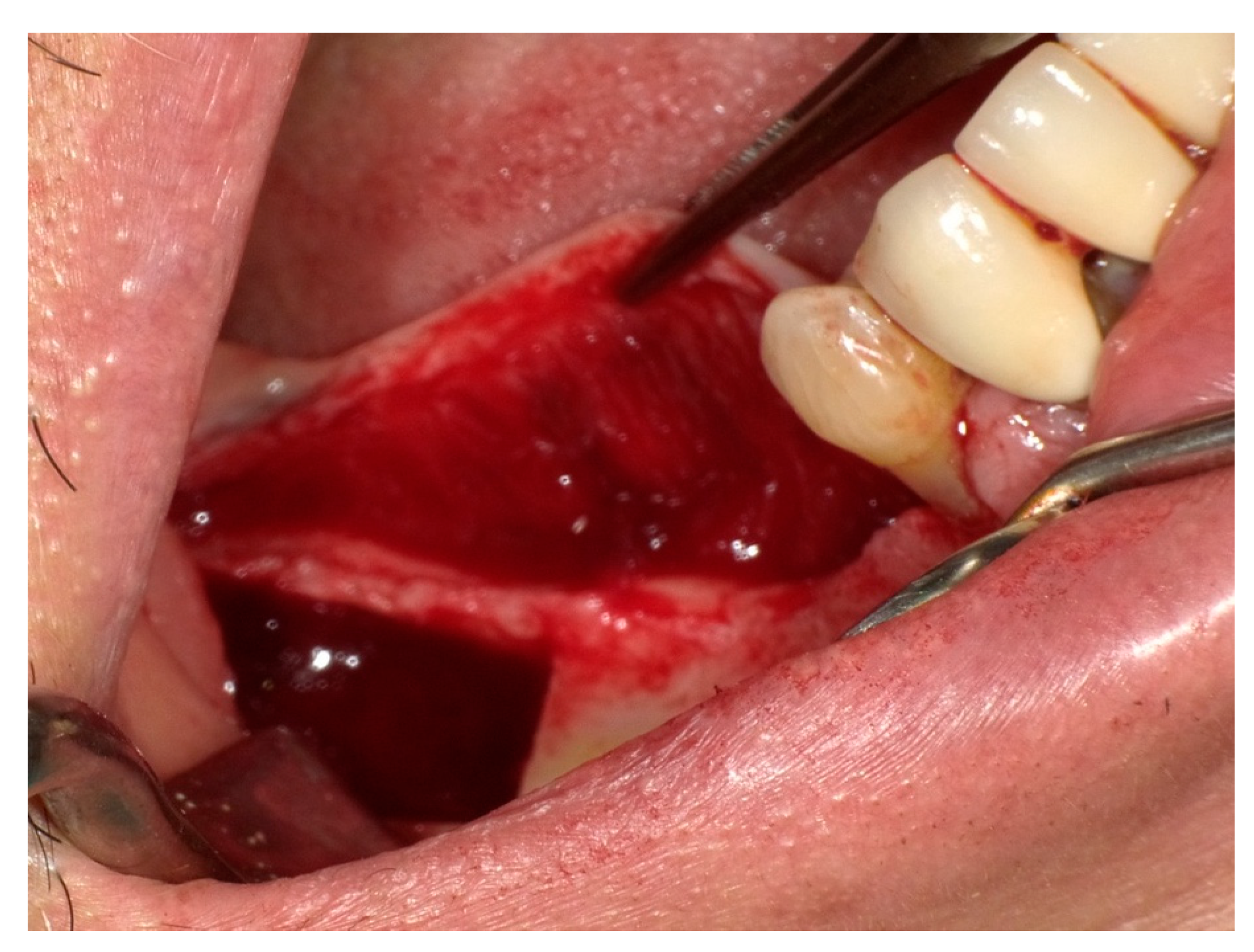 Diagnostics 15 01609 g003 Diagnostics 15 01609 g003