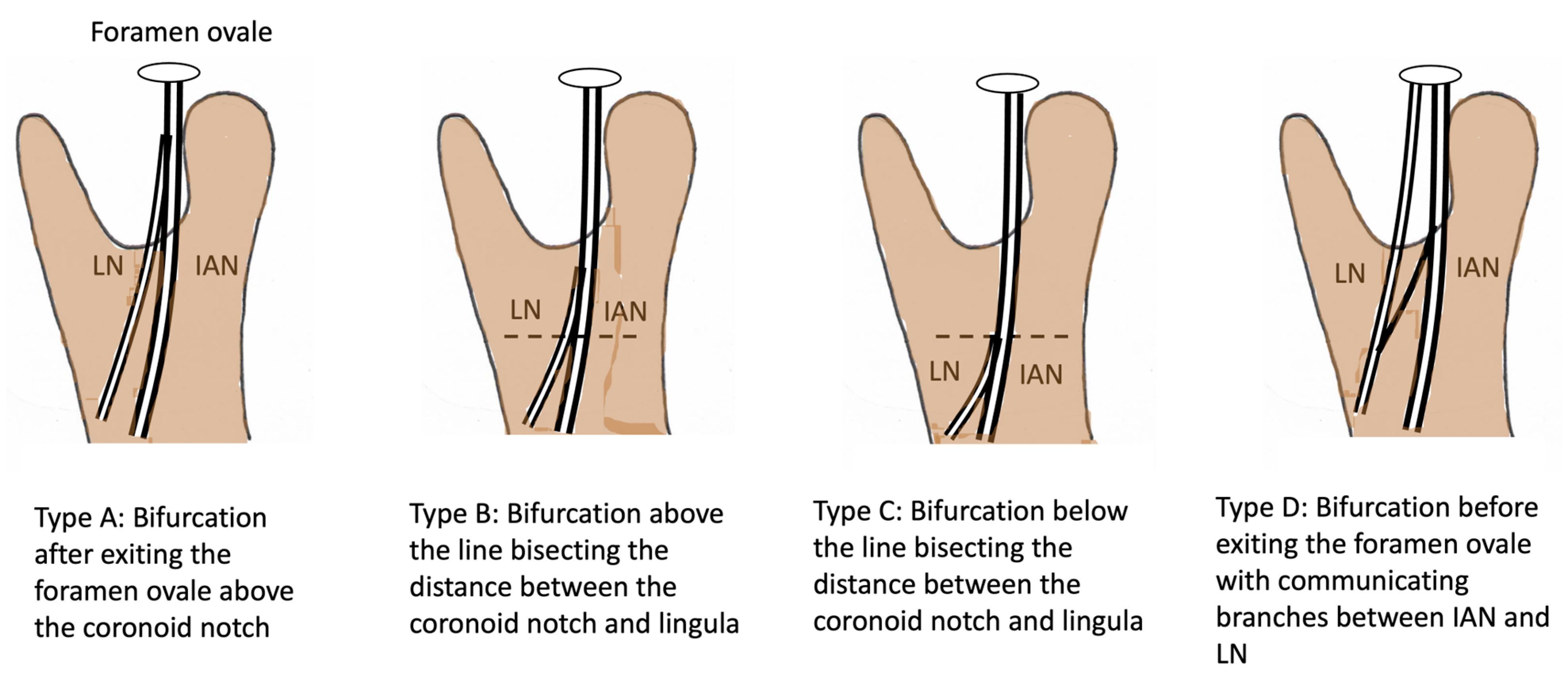 Diagnostics 15 01609 g006 Diagnostics 15 01609 g006