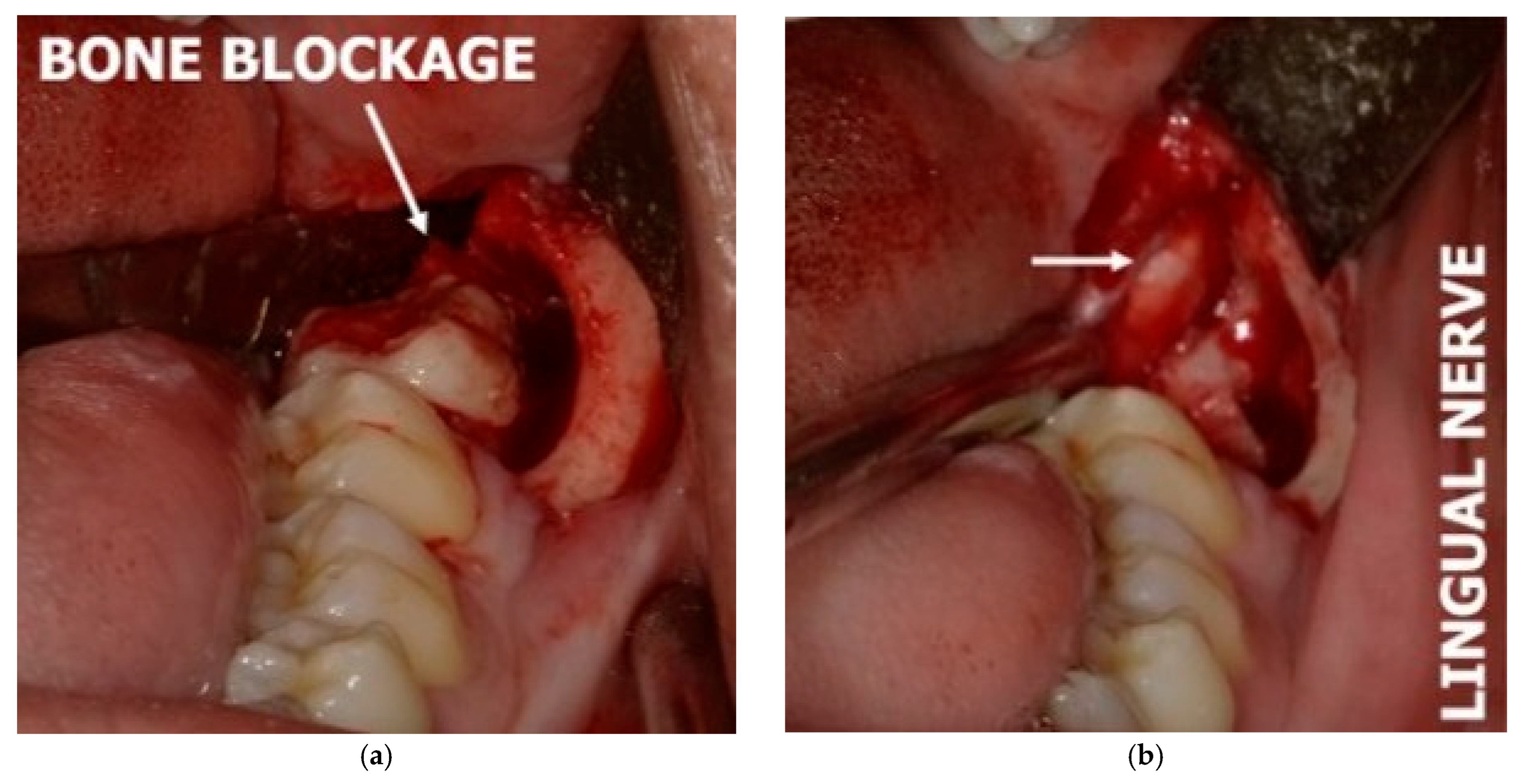 Diagnostics 15 01609 g007 Diagnostics 15 01609 g007