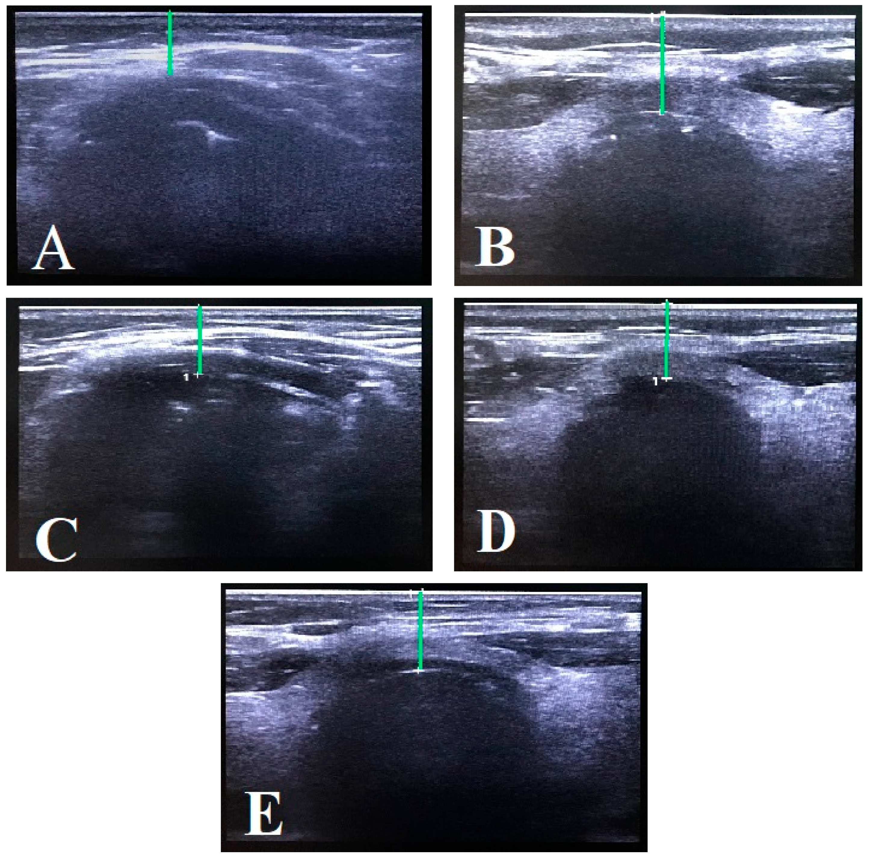 Diagnostics 15 01615 g001
