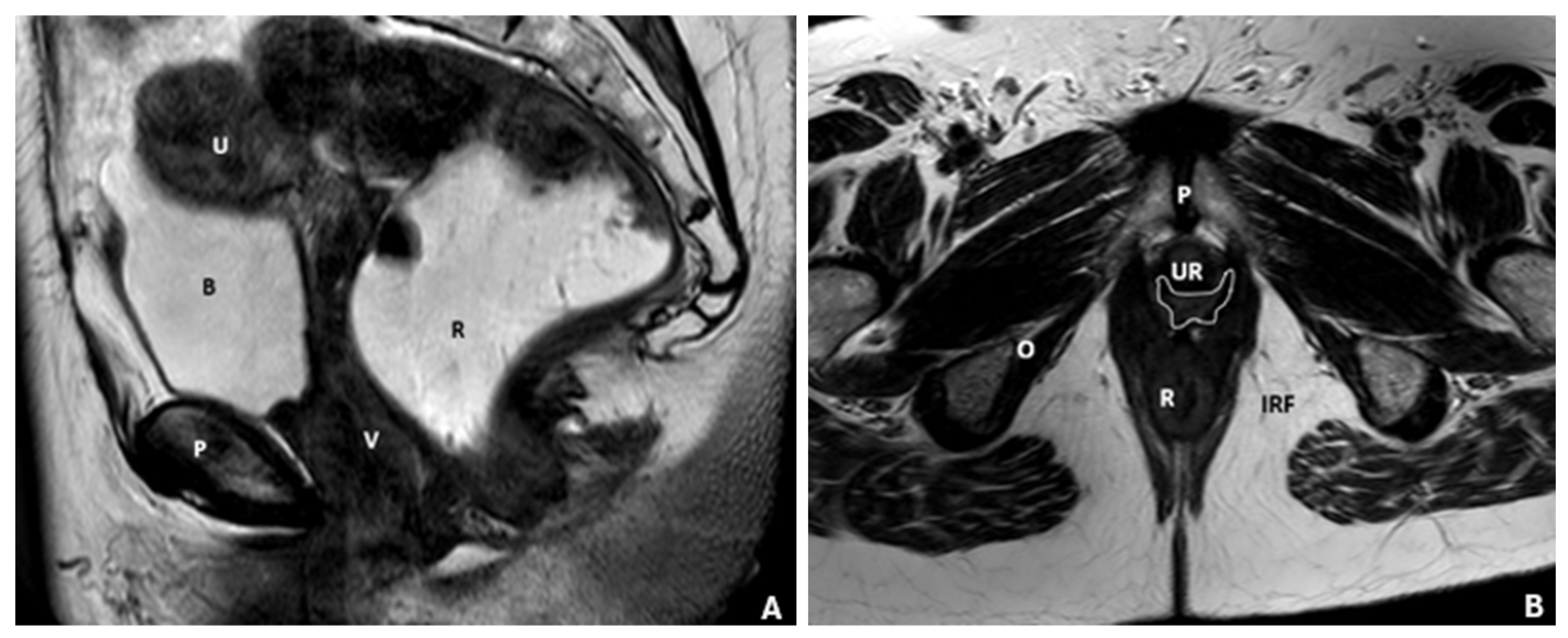 Diagnostics 15 01625 g001