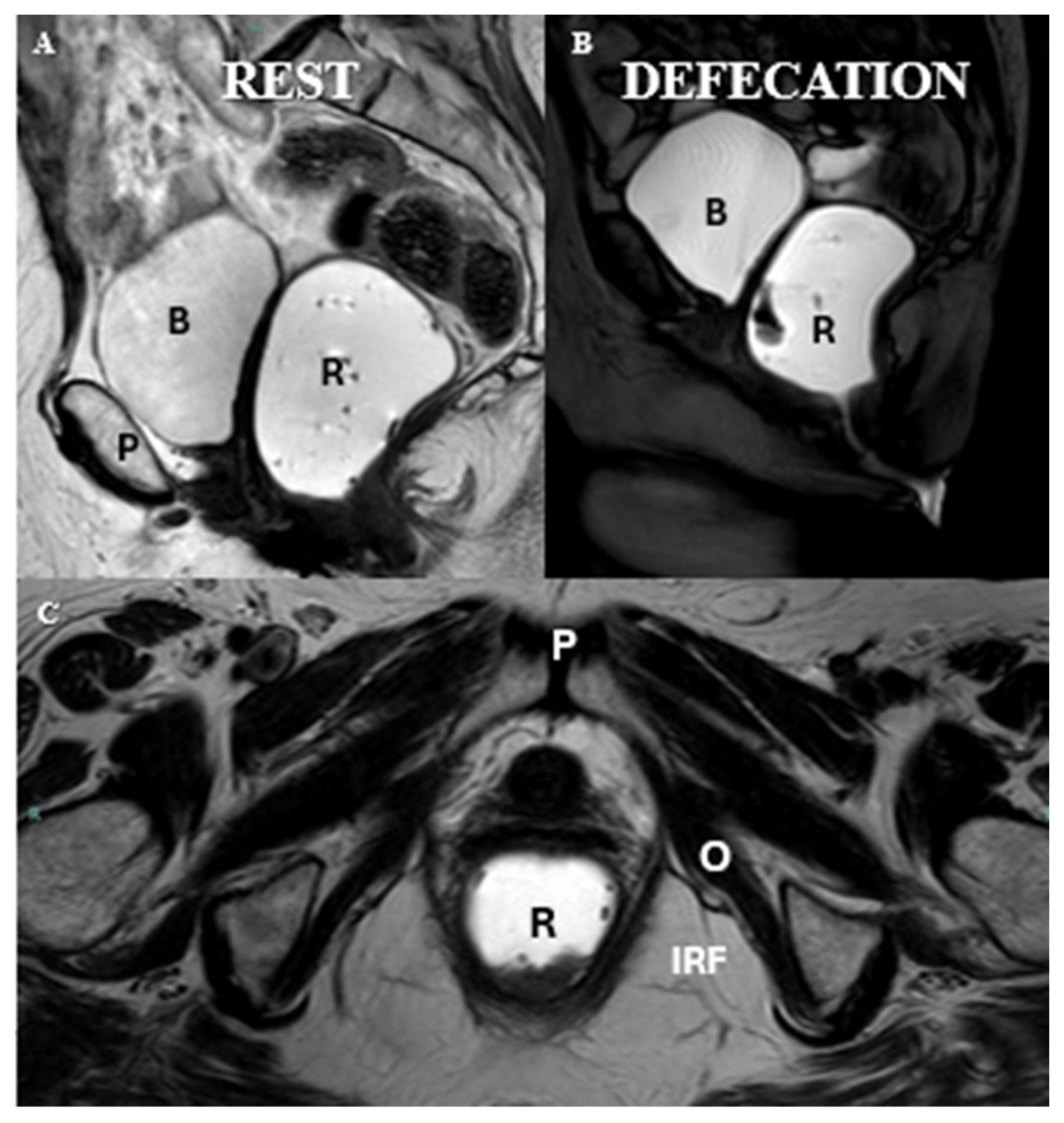 Diagnostics 15 01625 g005
