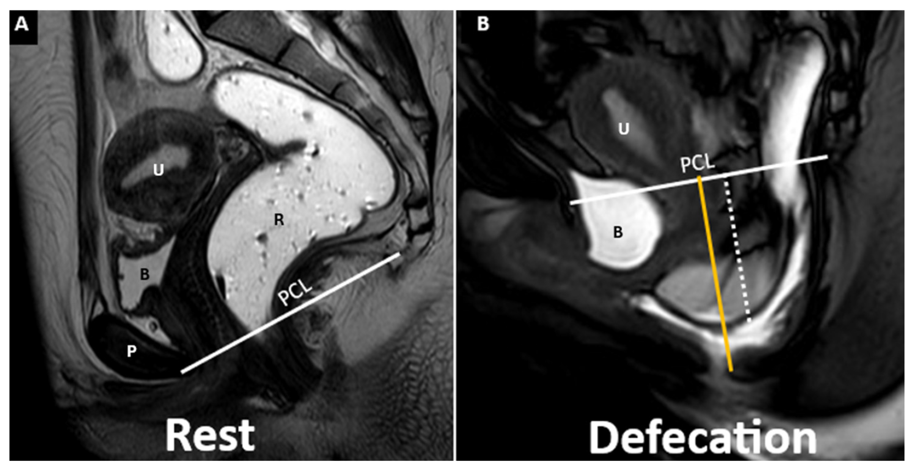 Diagnostics 15 01625 g010