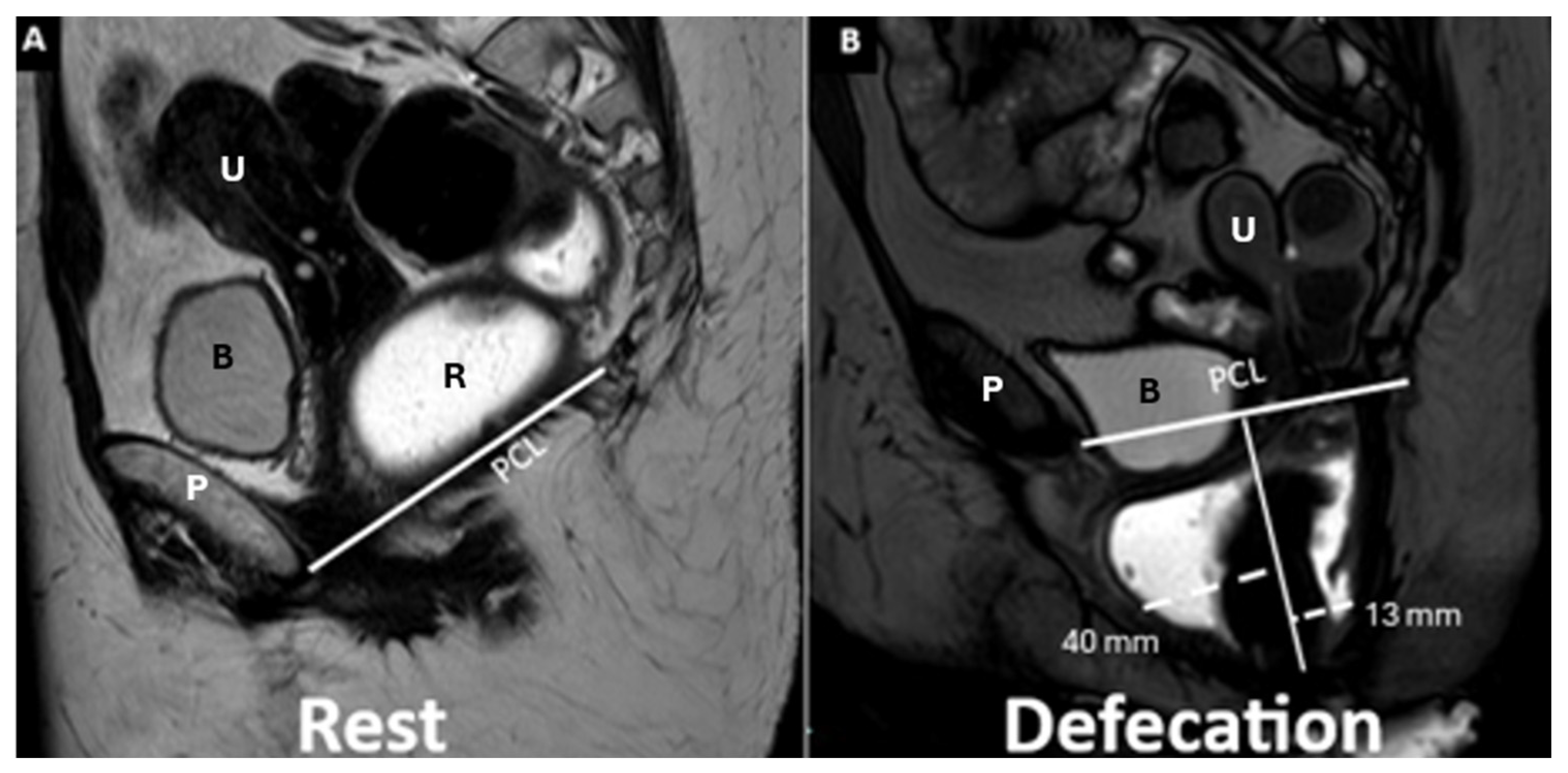 Diagnostics 15 01625 g011