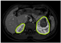 Diagnostics 15 01636 i001