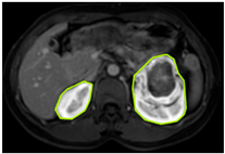 Diagnostics 15 01636 i003