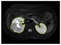Diagnostics 15 01636 i005