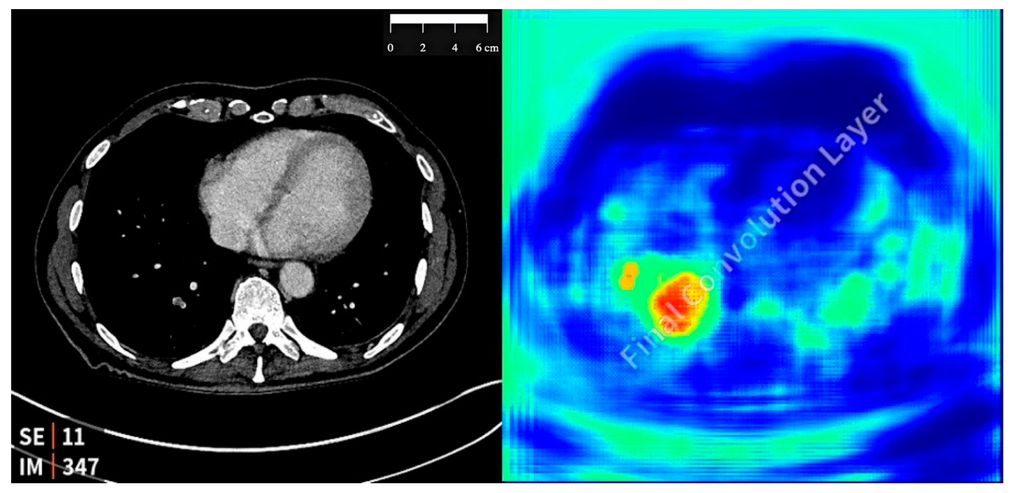 Diagnostics 15 01639 g001