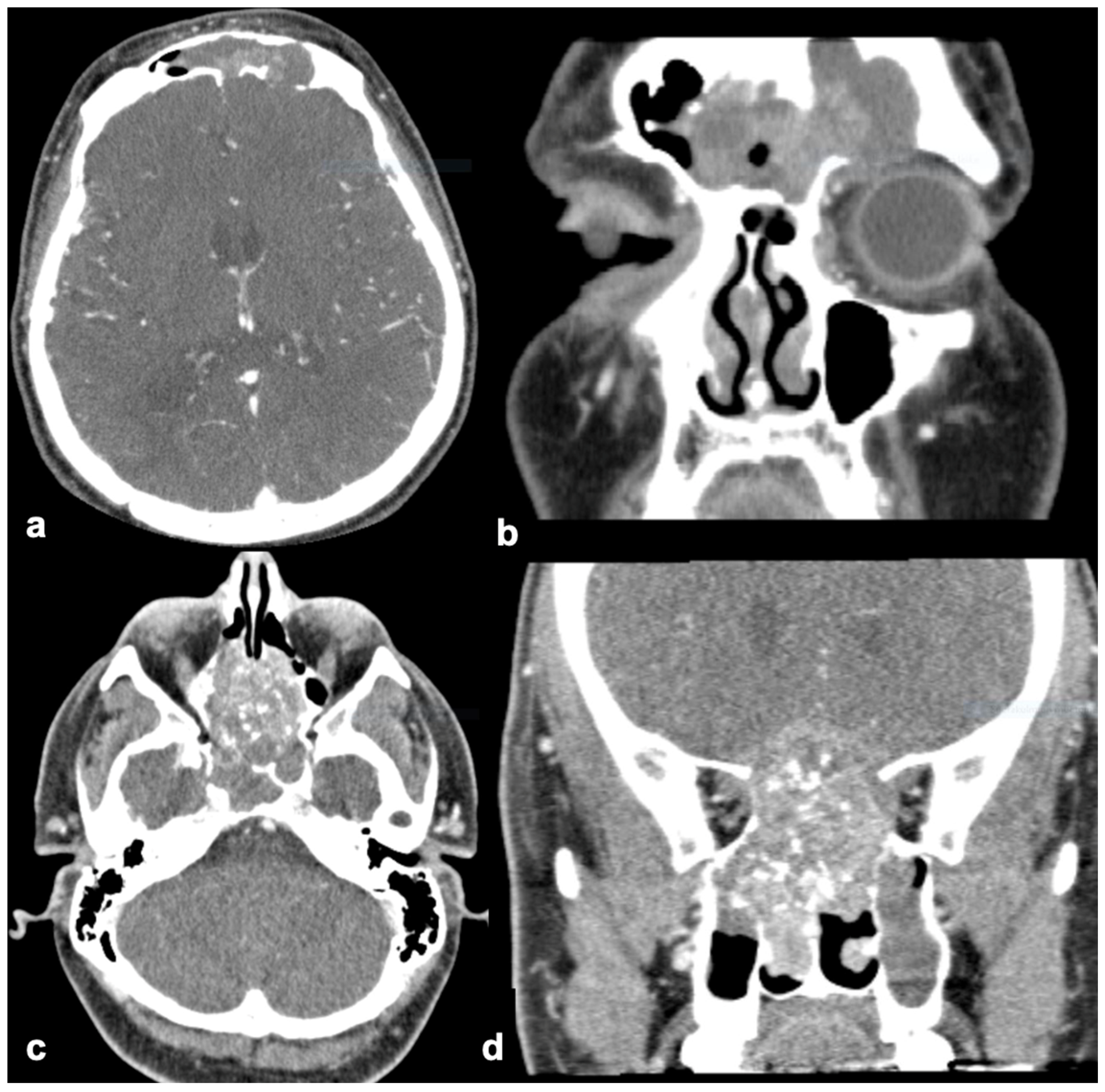 Diagnostics 15 01645 g002