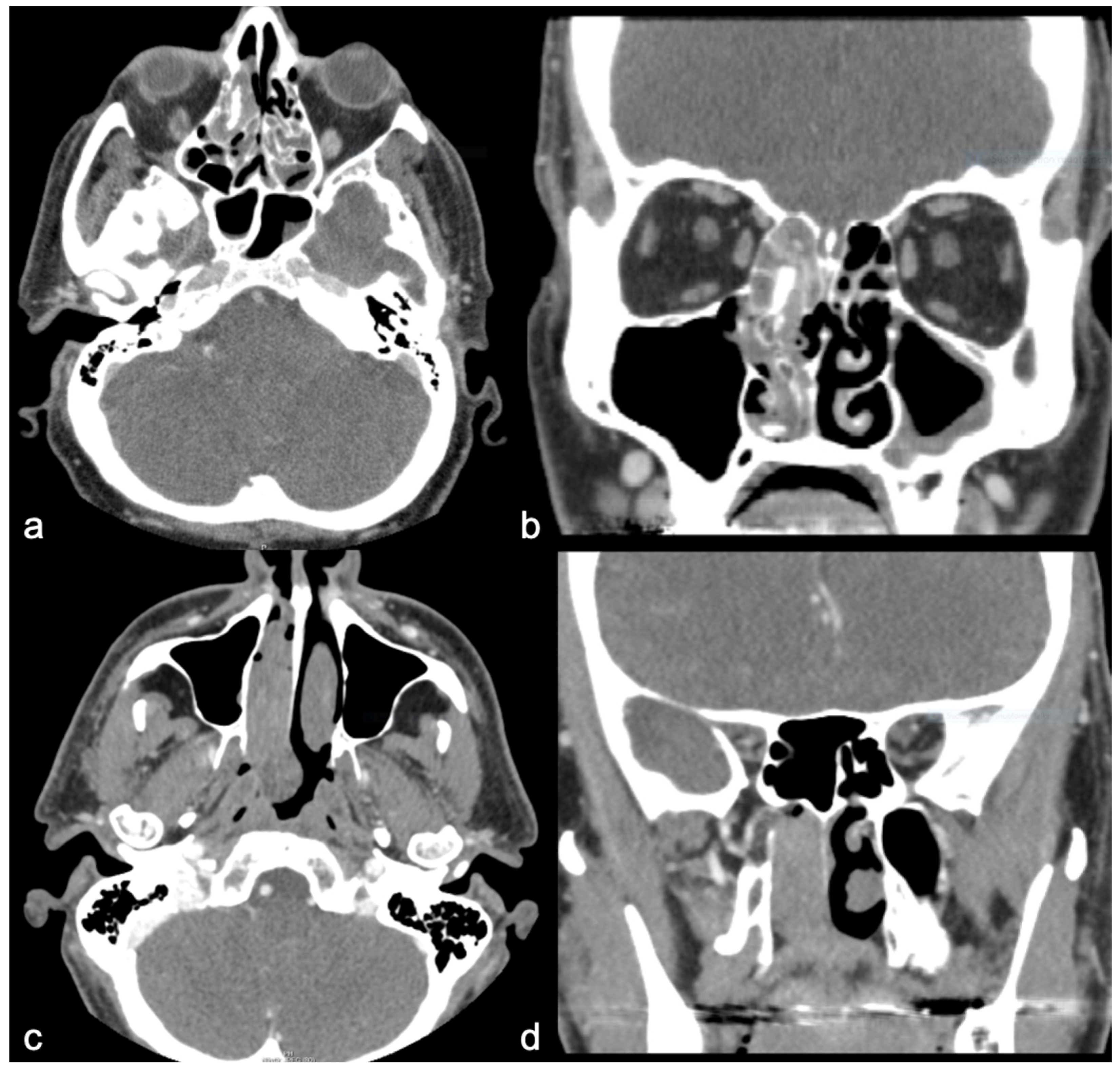 Diagnostics 15 01645 g003