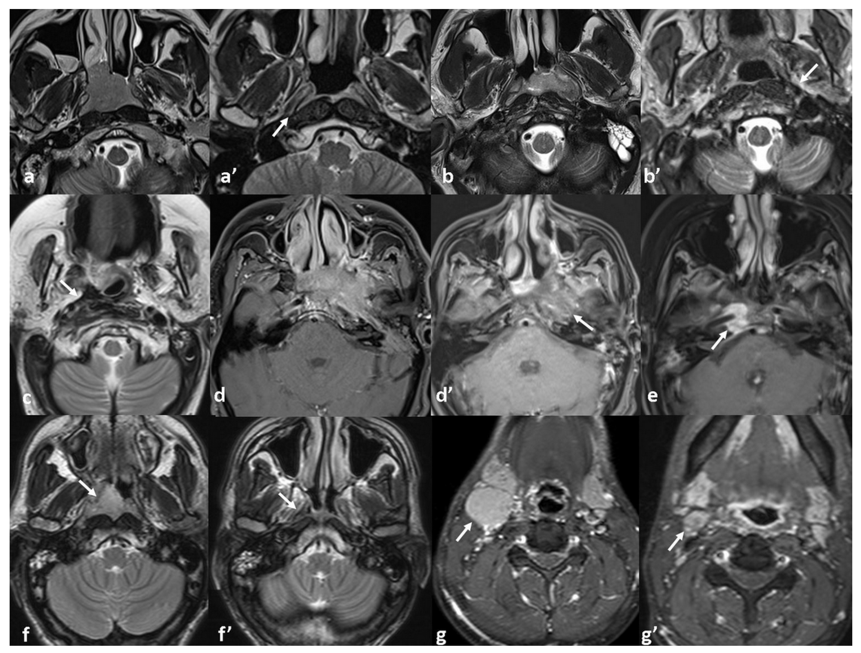 Diagnostics 15 01646 g003