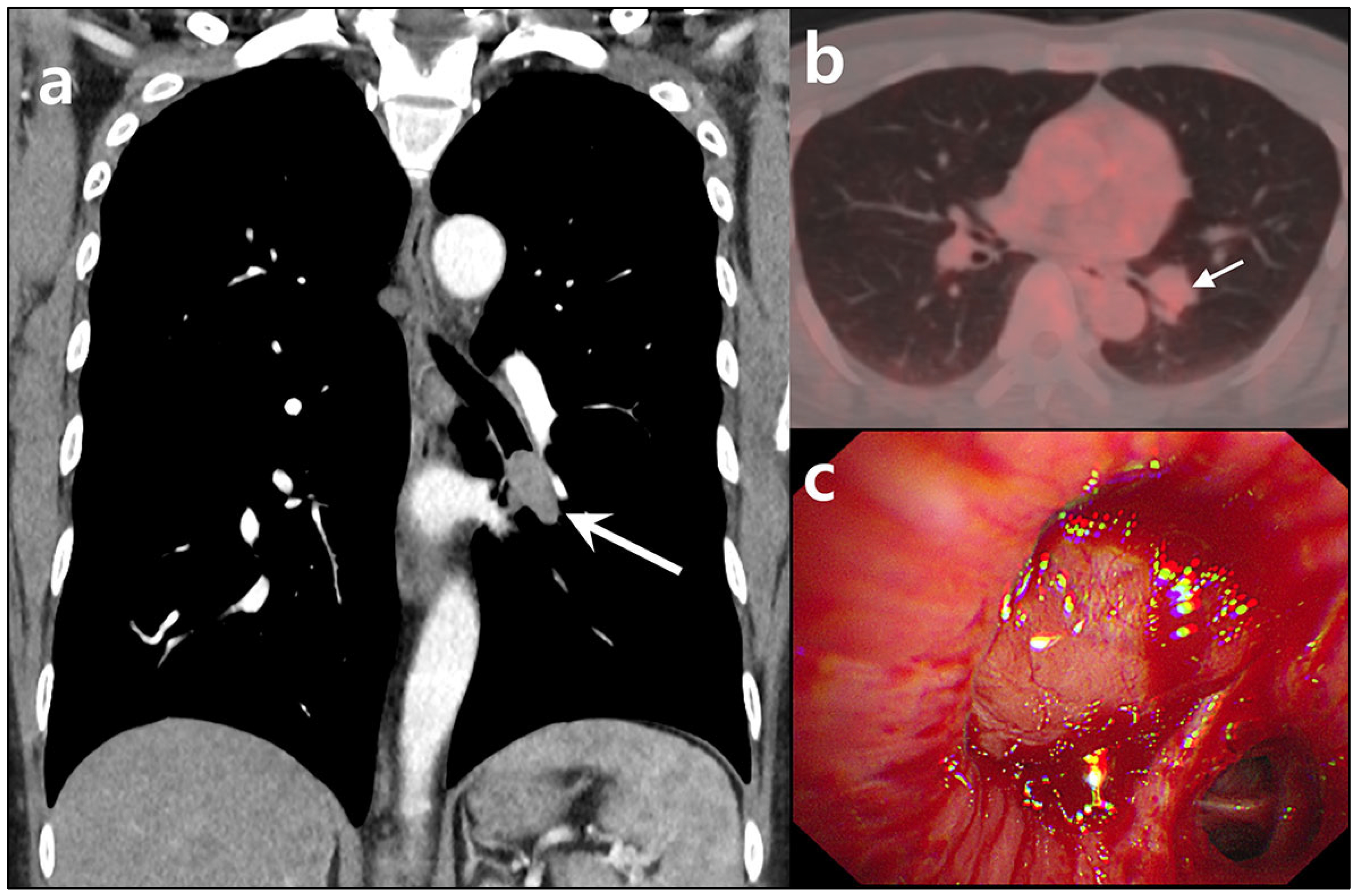 Diagnostics 15 01651 g001