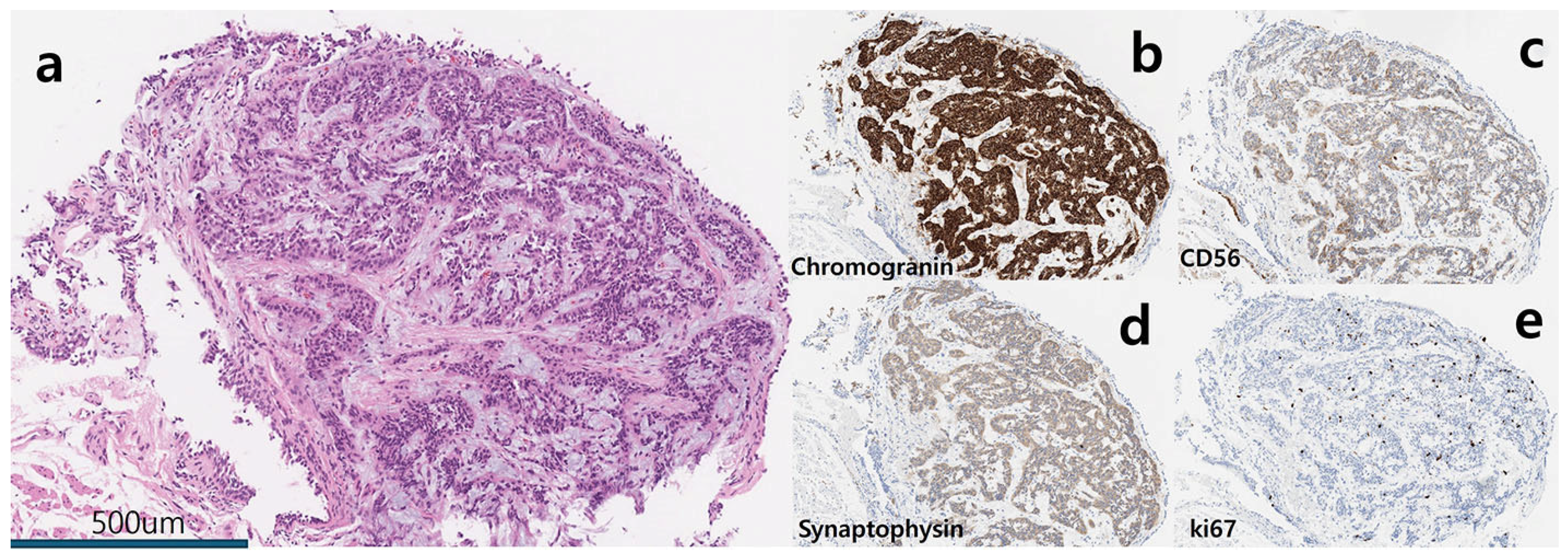 Diagnostics 15 01651 g005