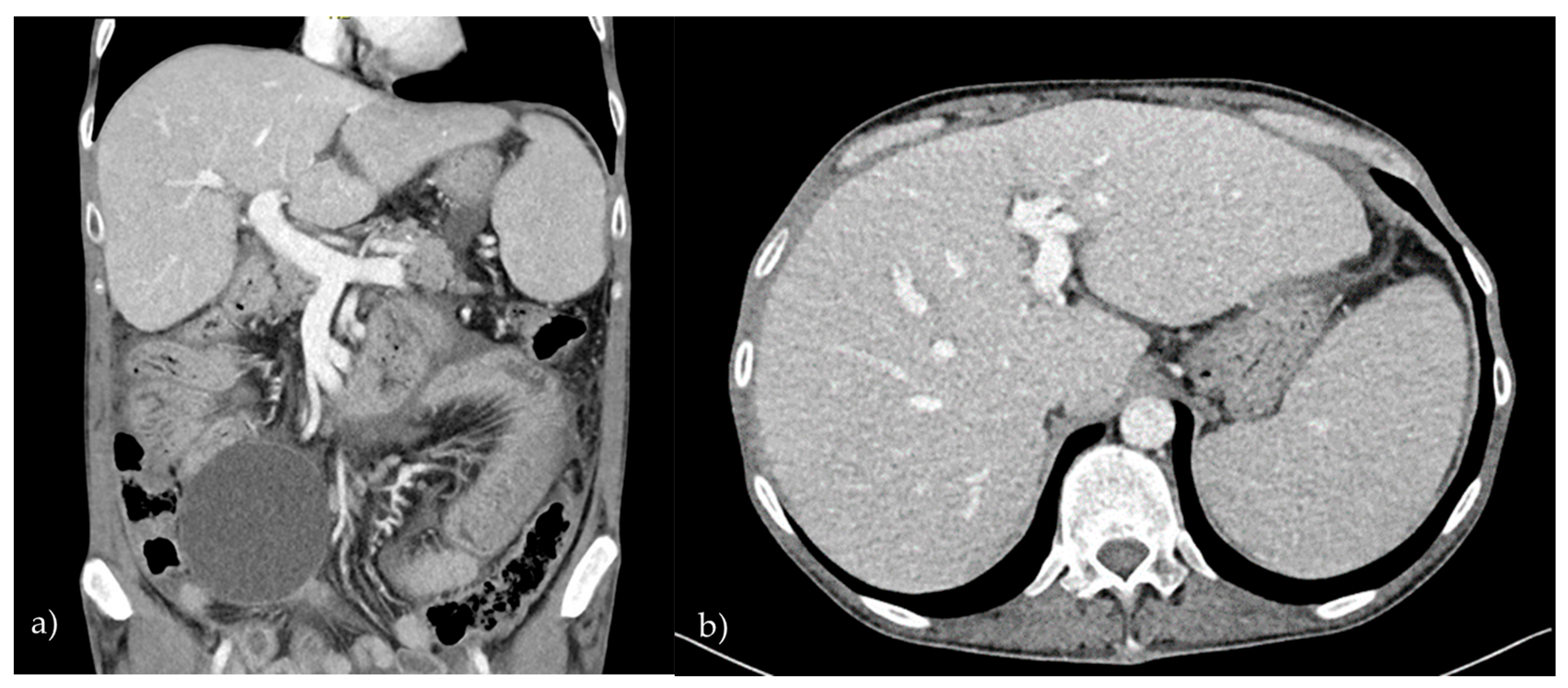Diagnostics 15 01659 g001