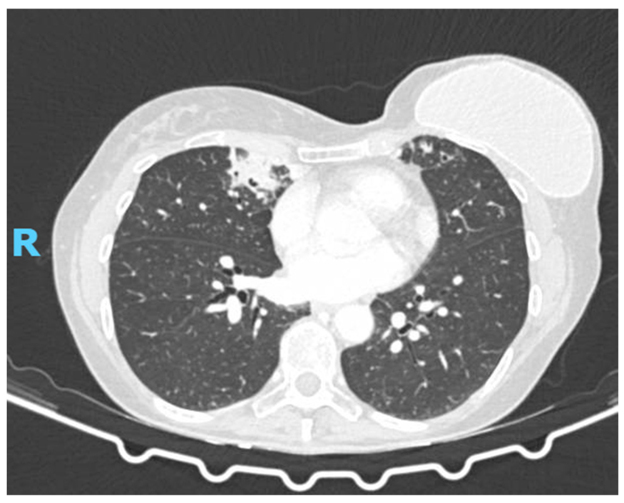 Diagnostics 15 01661 g001