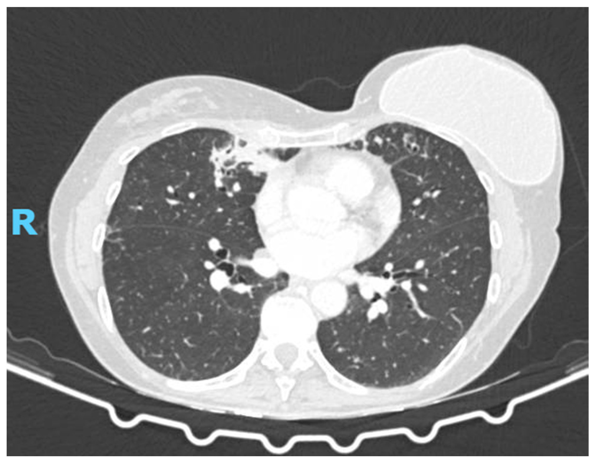Diagnostics 15 01661 g002a