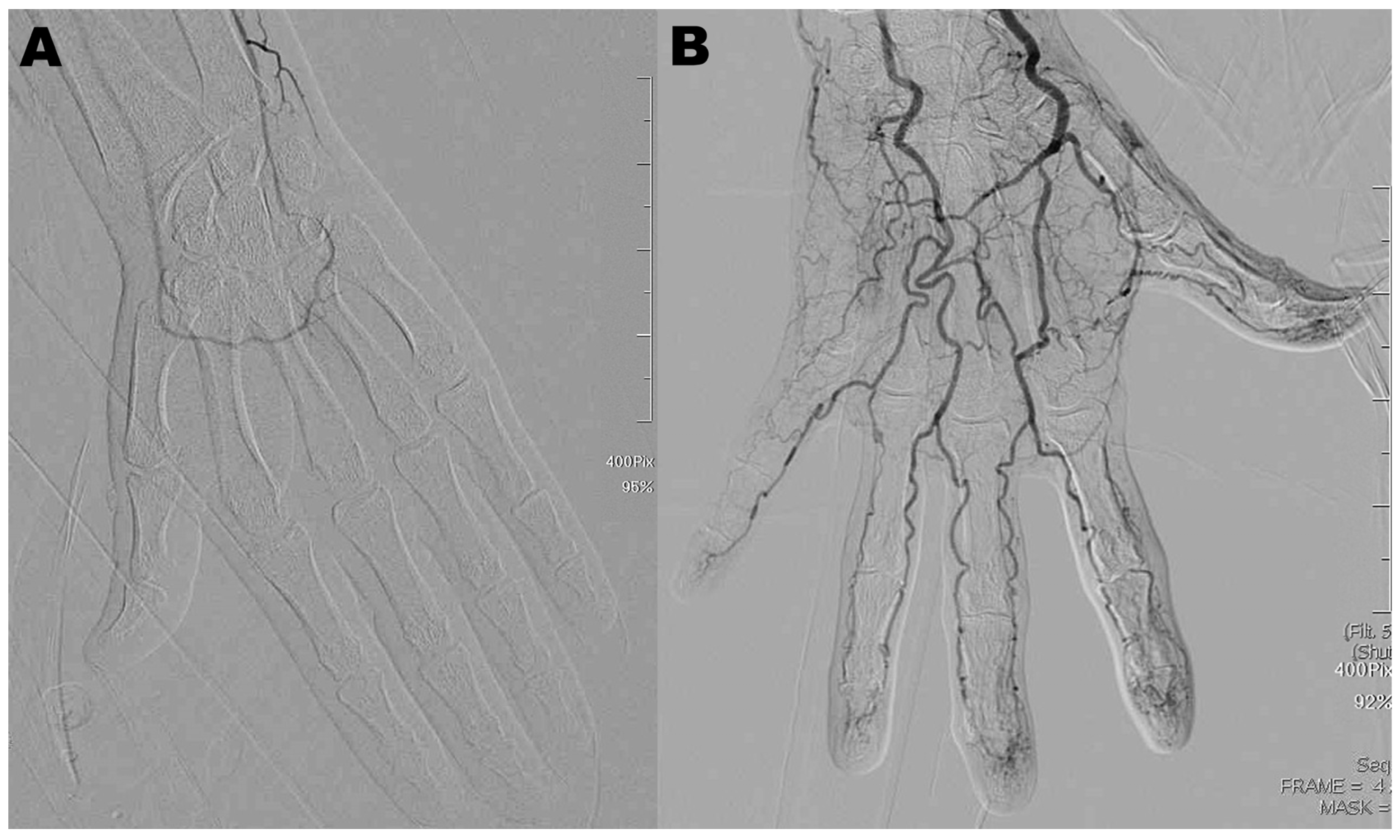 Diagnostics 15 01667 g001 Diagnostics 15 01667 g001