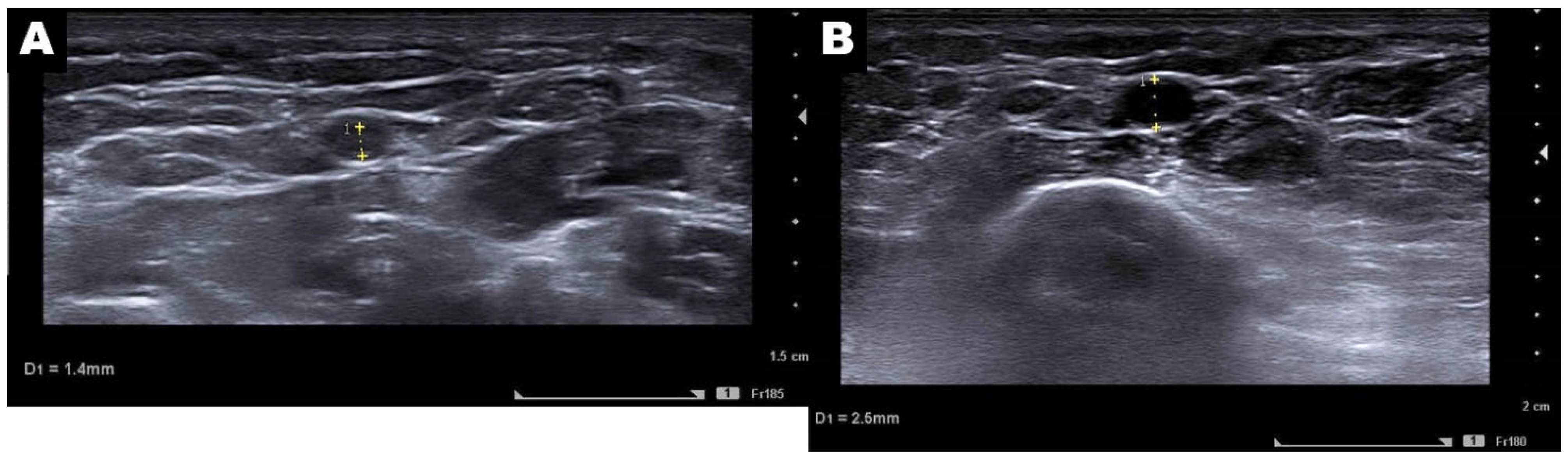 Diagnostics 15 01667 g003 Diagnostics 15 01667 g003