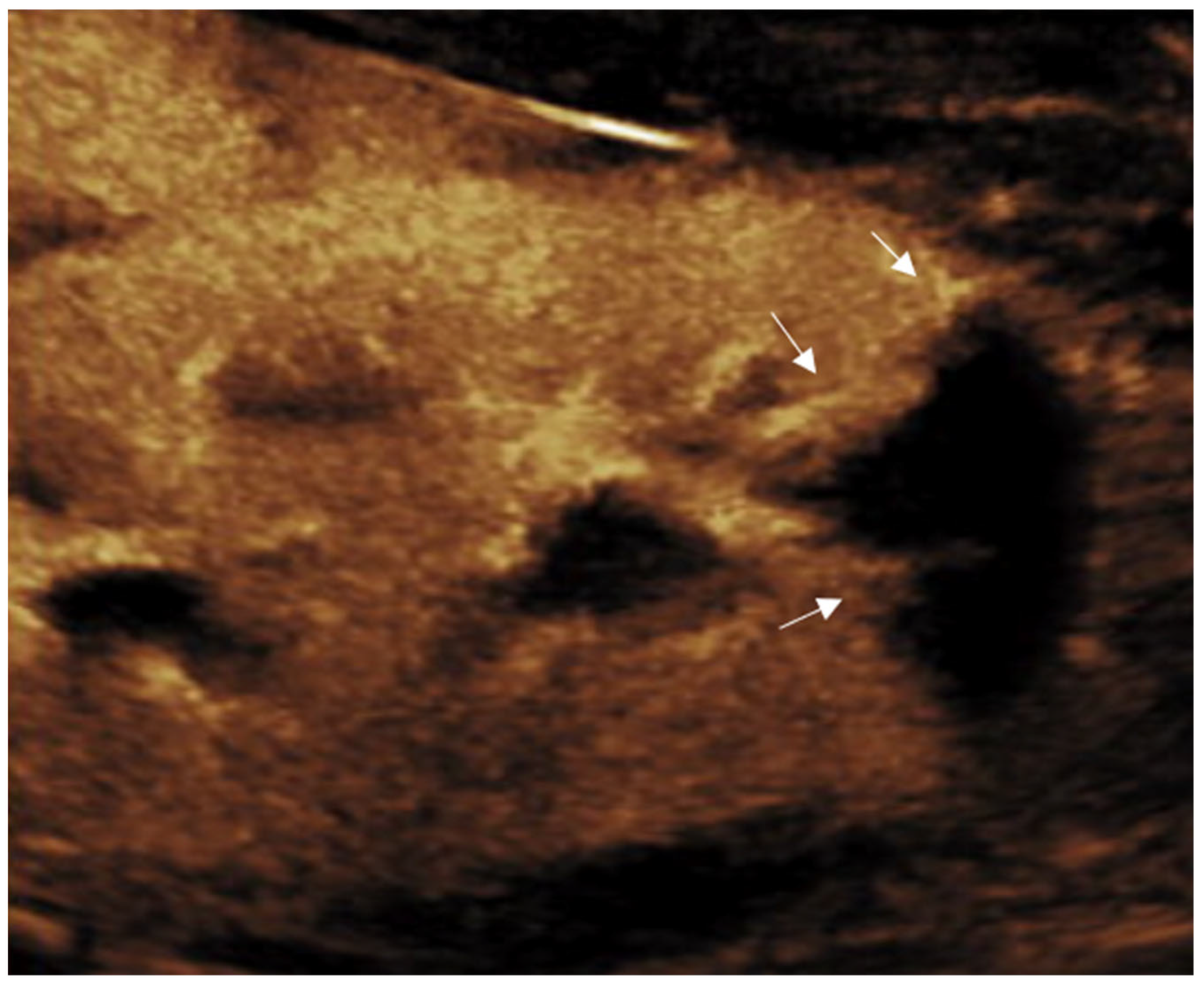 Diagnostics 15 01680 g004