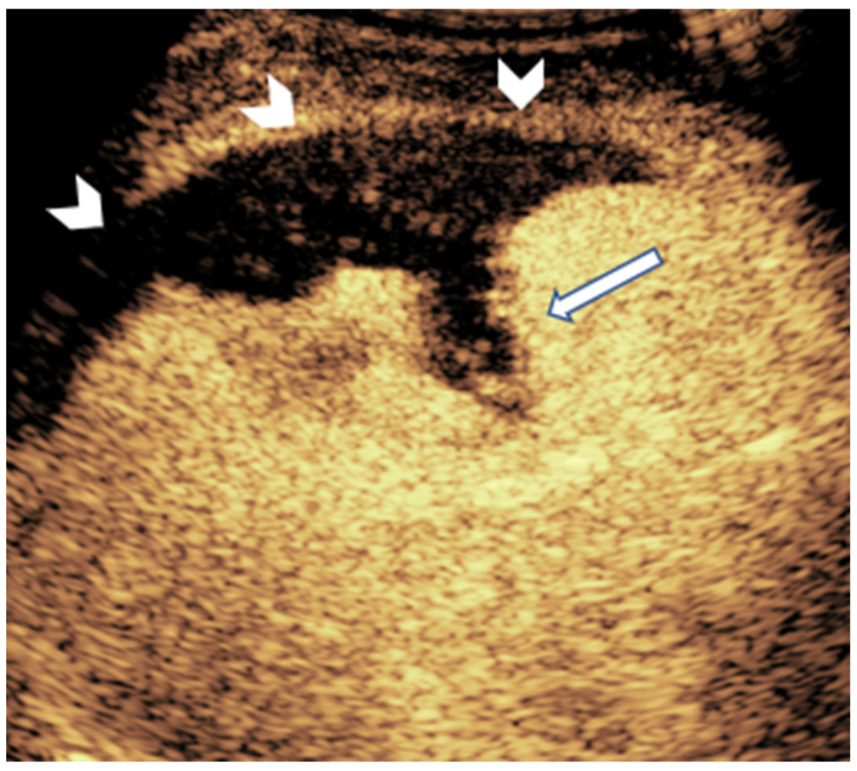 Diagnostics 15 01680 g007