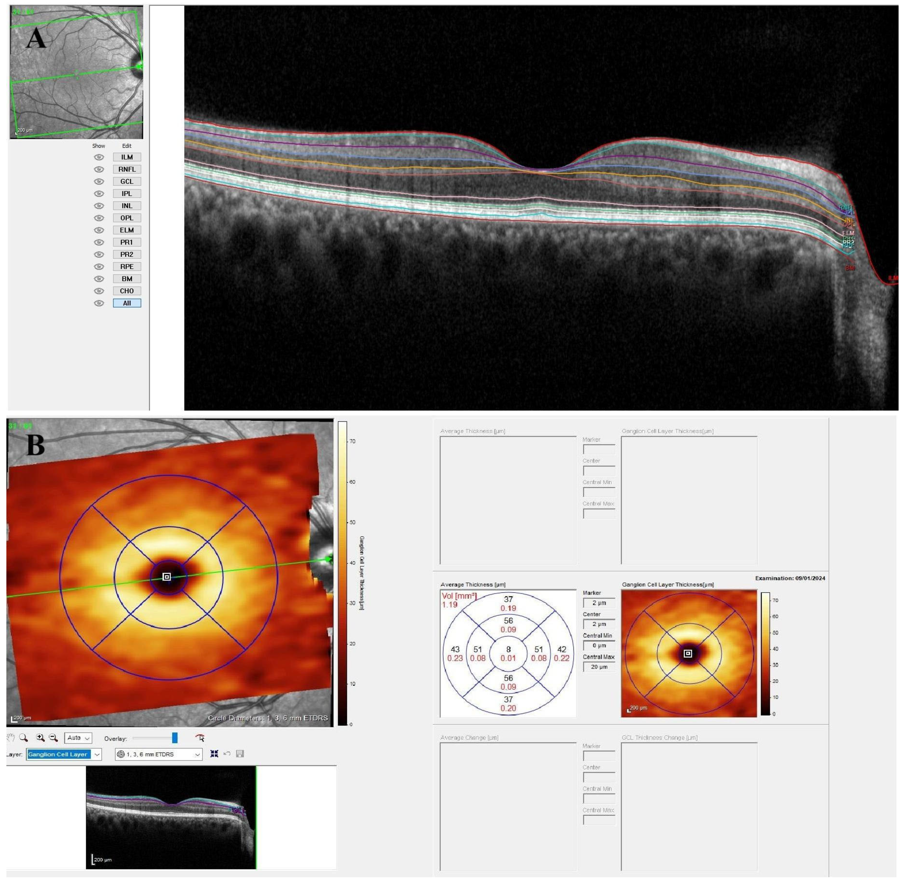 Diagnostics 15 01682 g001 Diagnostics 15 01682 g001