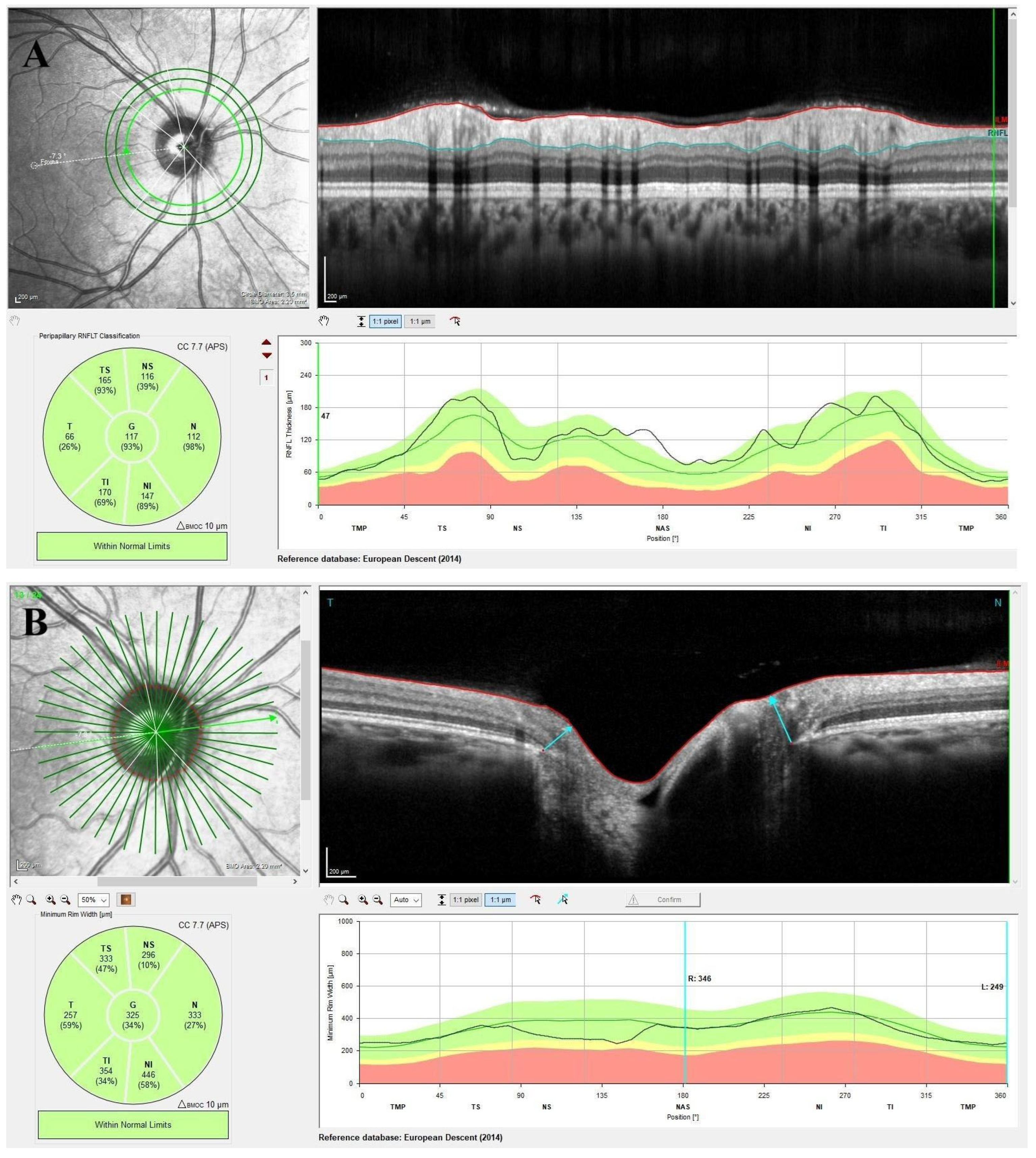 Diagnostics 15 01682 g002 Diagnostics 15 01682 g002