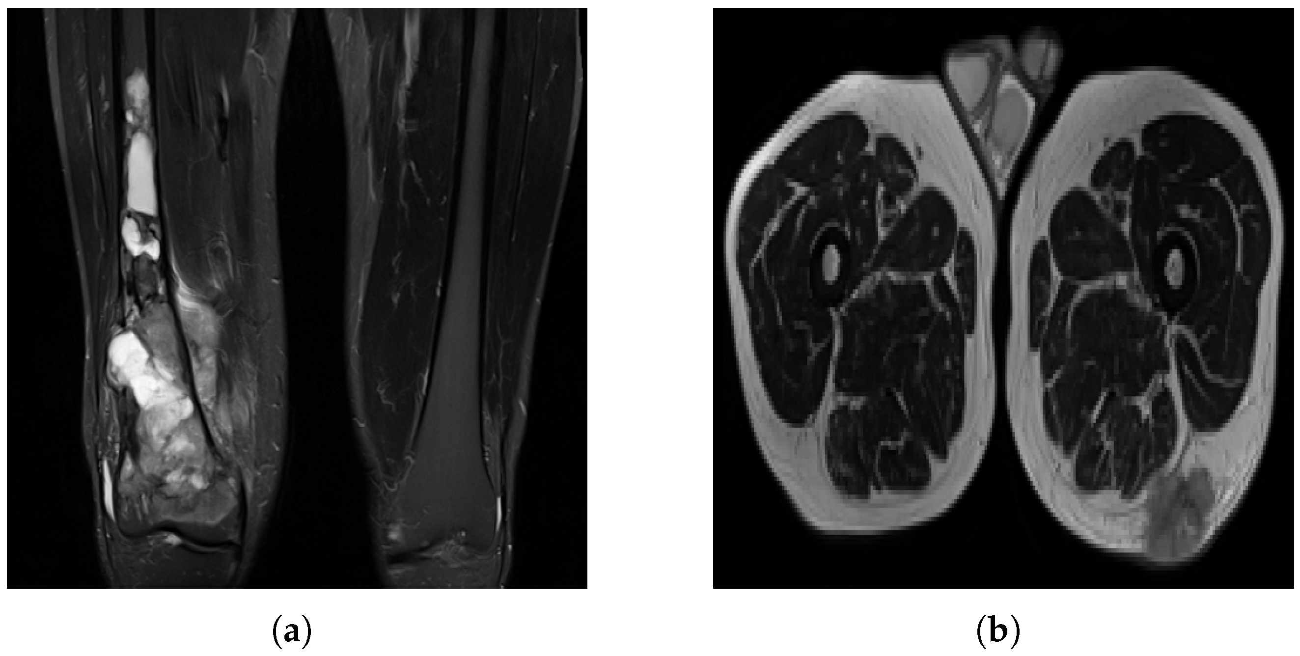 Diagnostics 15 01694 g003