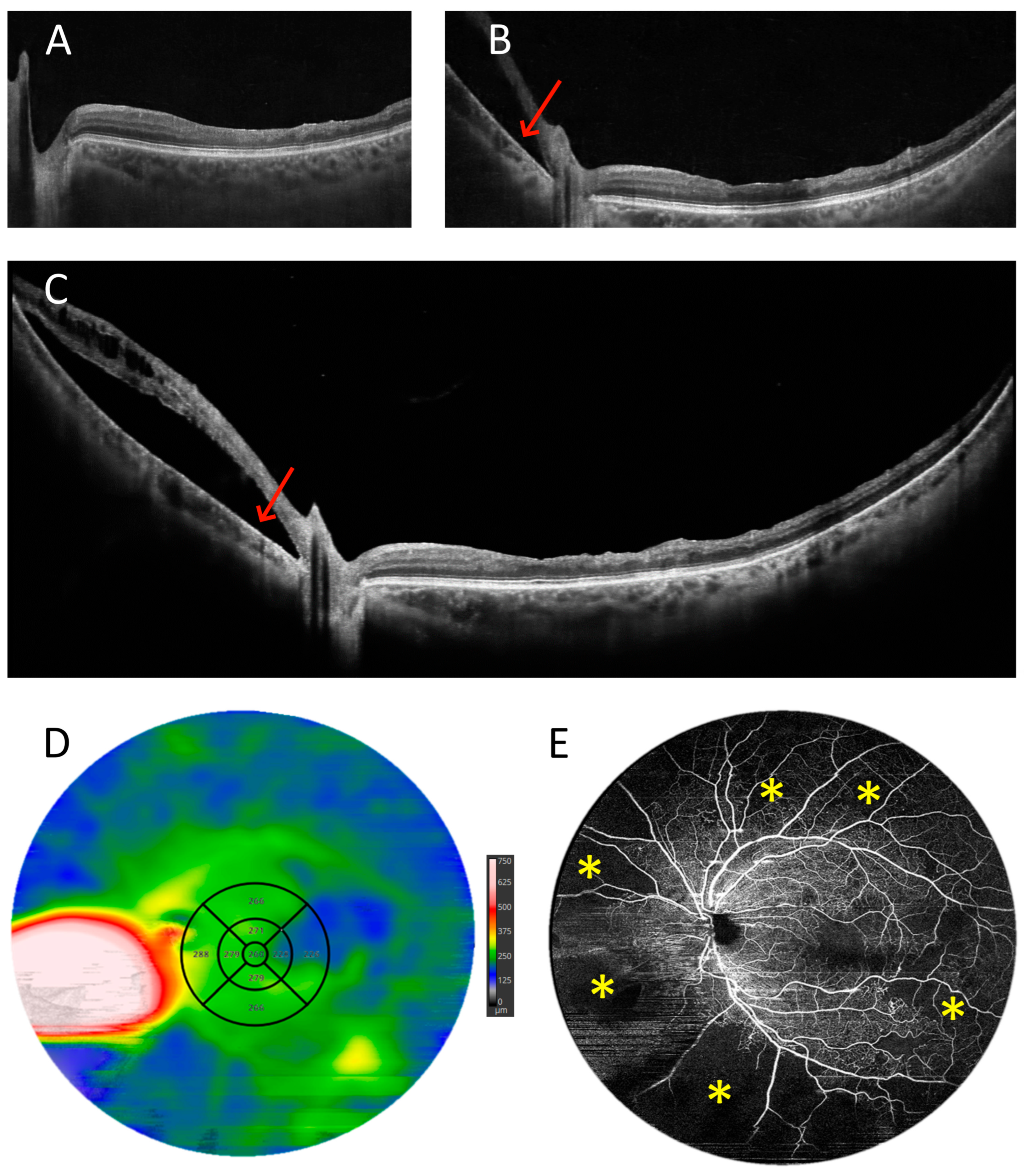 Diagnostics 15 01697 g014
