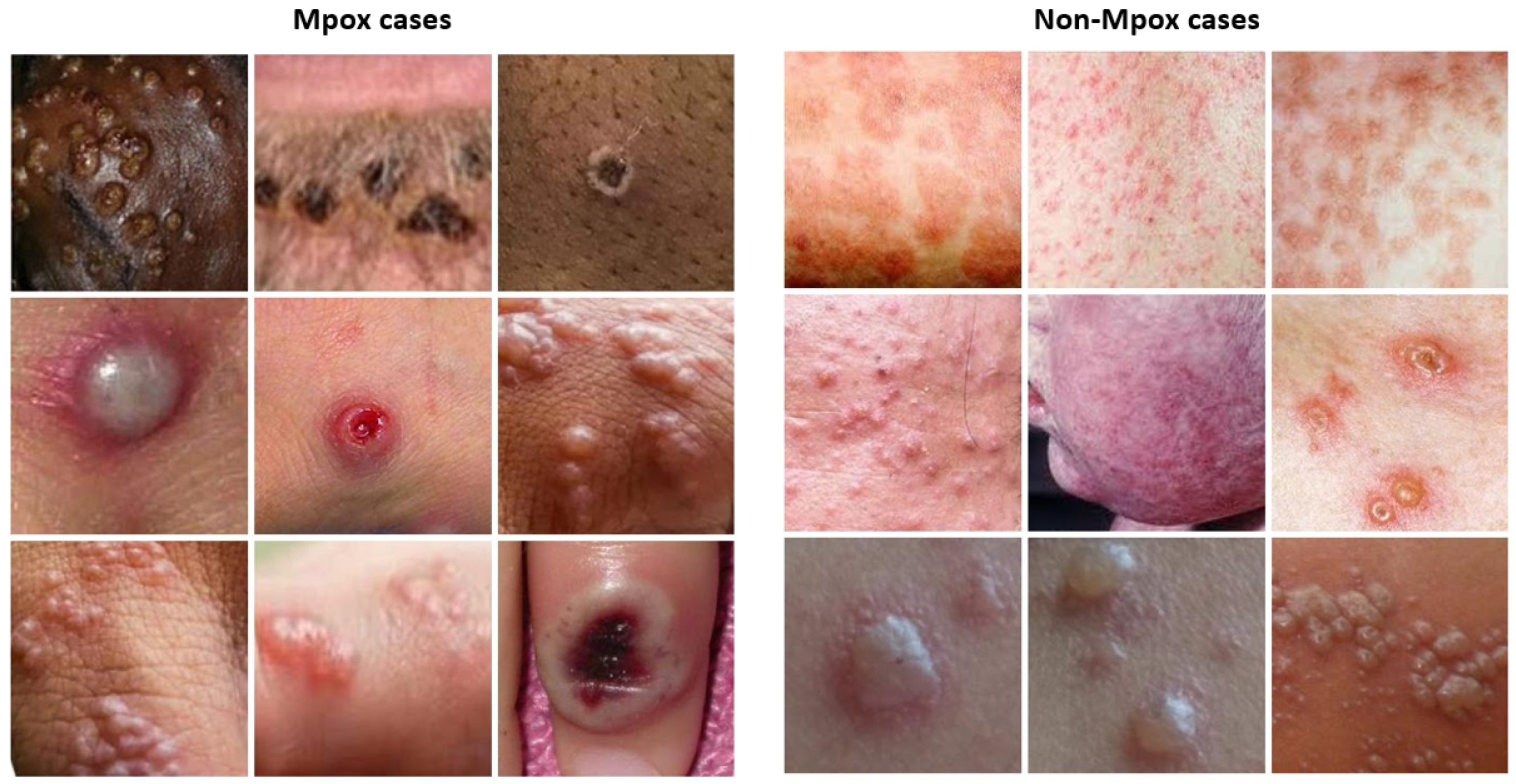 Diagnostics 15 01698 g001