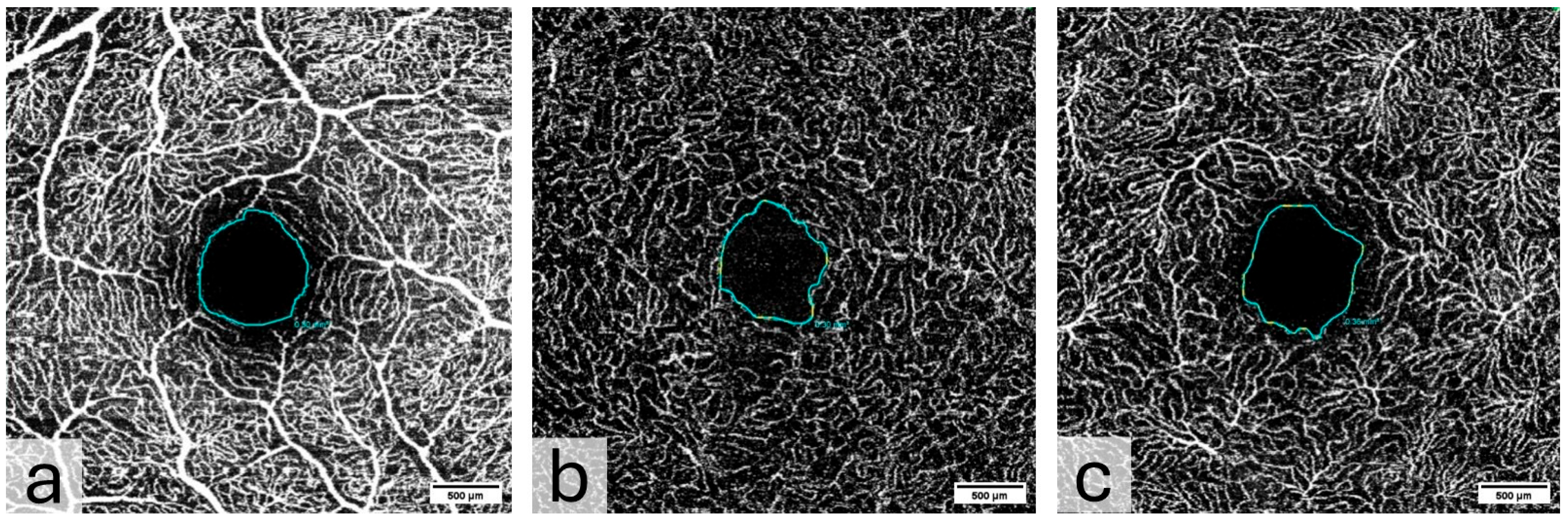 Diagnostics 15 01701 g004