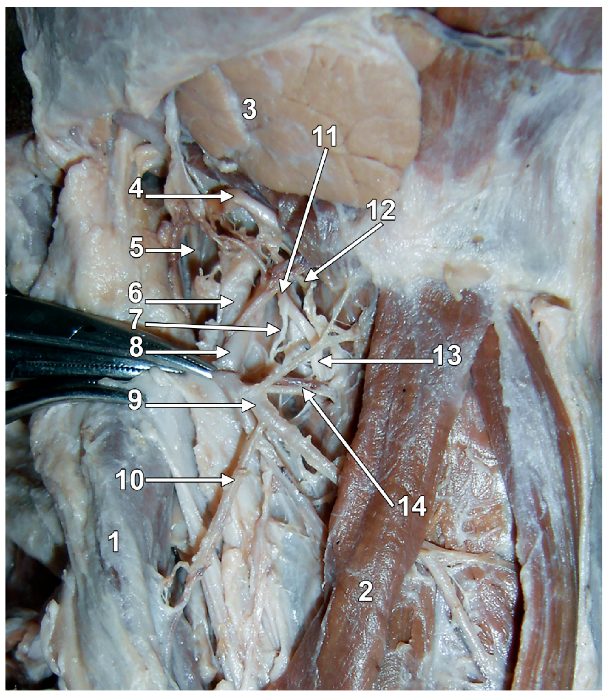 Diagnostics 15 01711 g001