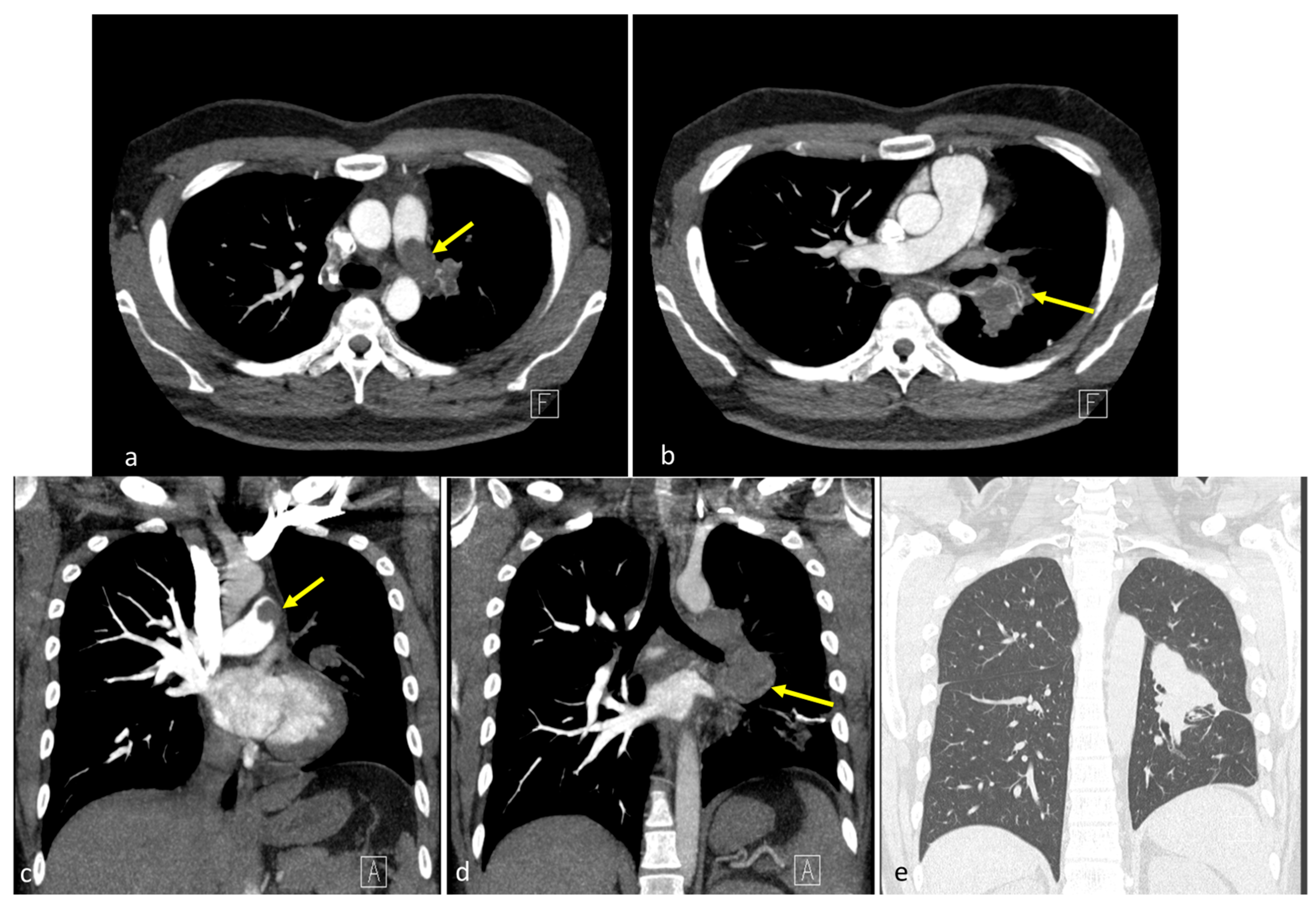 Diagnostics 15 01718 g001
