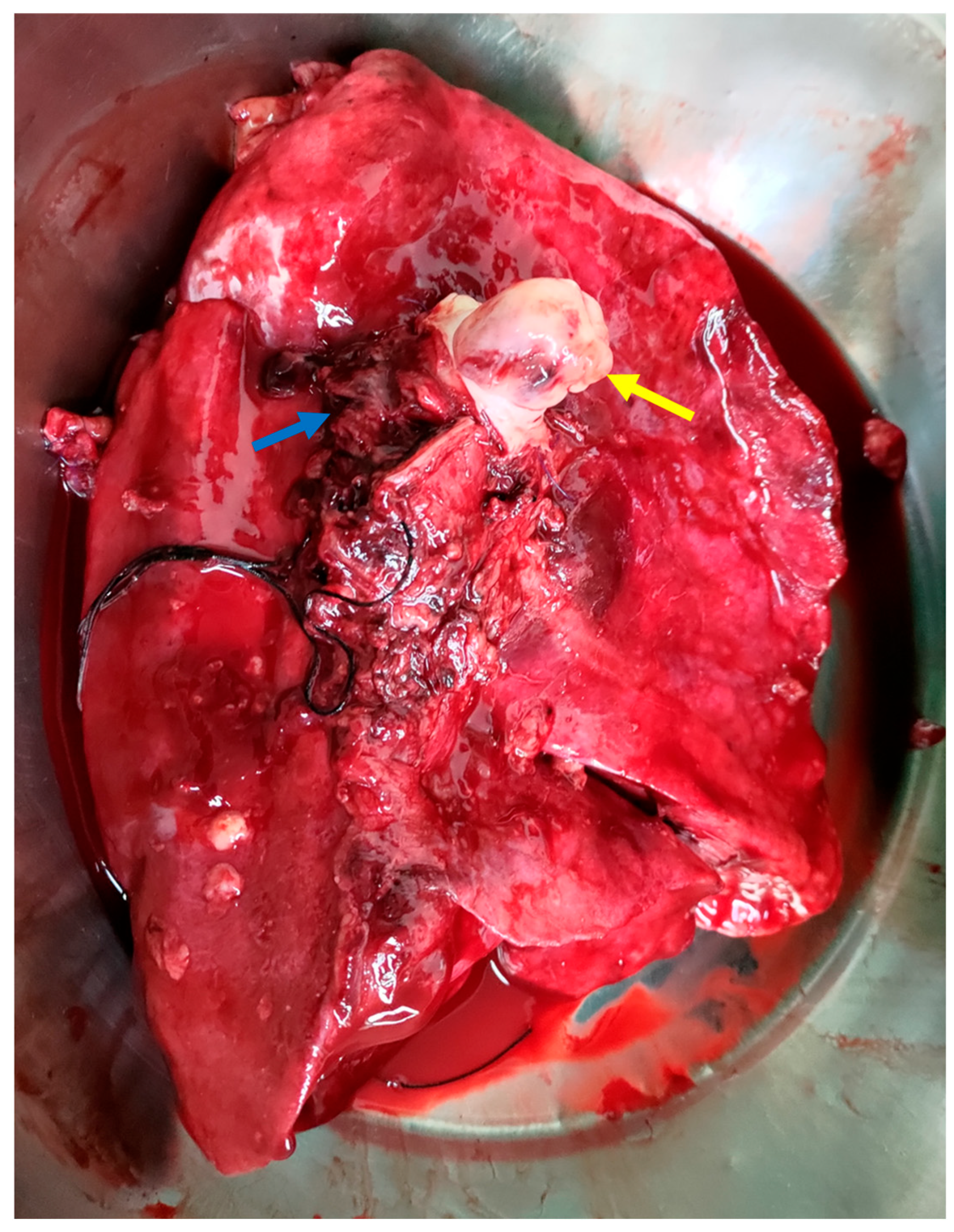 Diagnostics 15 01718 g003