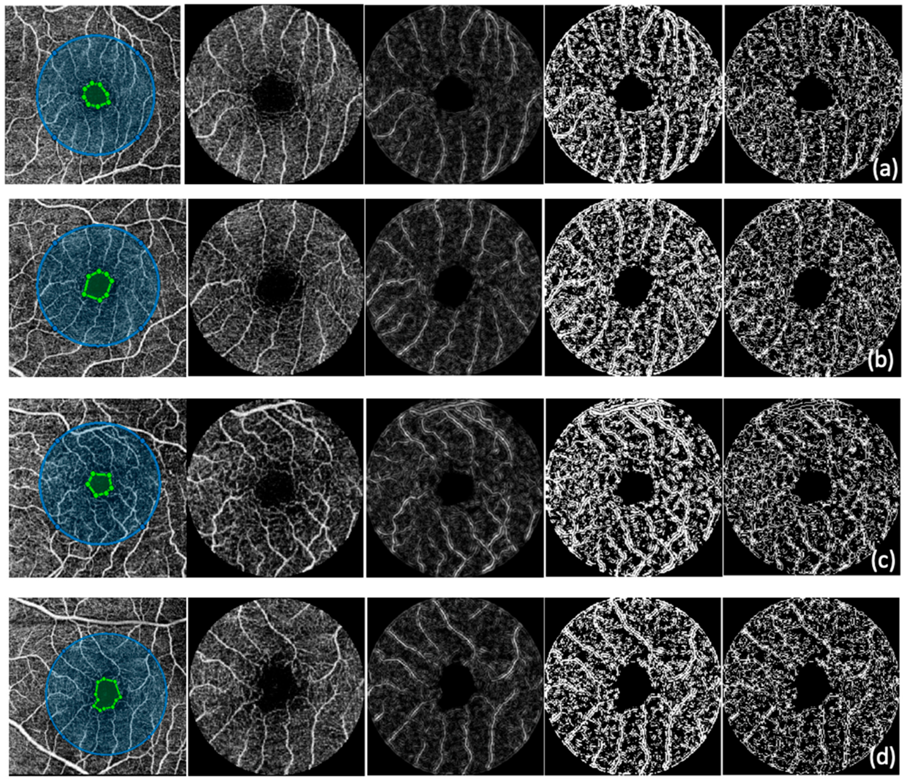 Diagnostics 15 01732 g001
