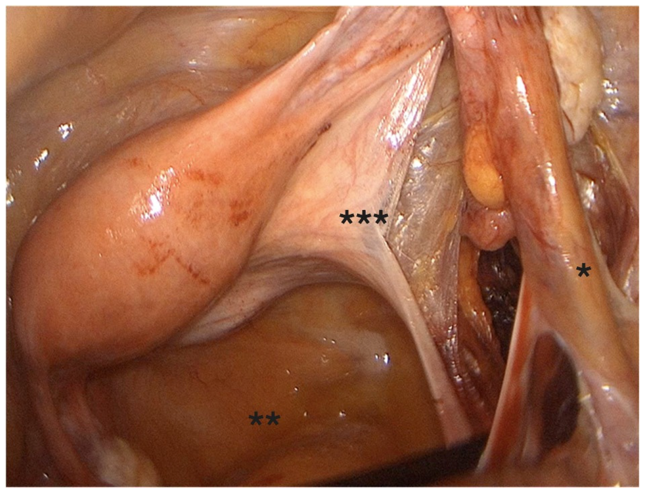 Diagnostics 15 01736 g003