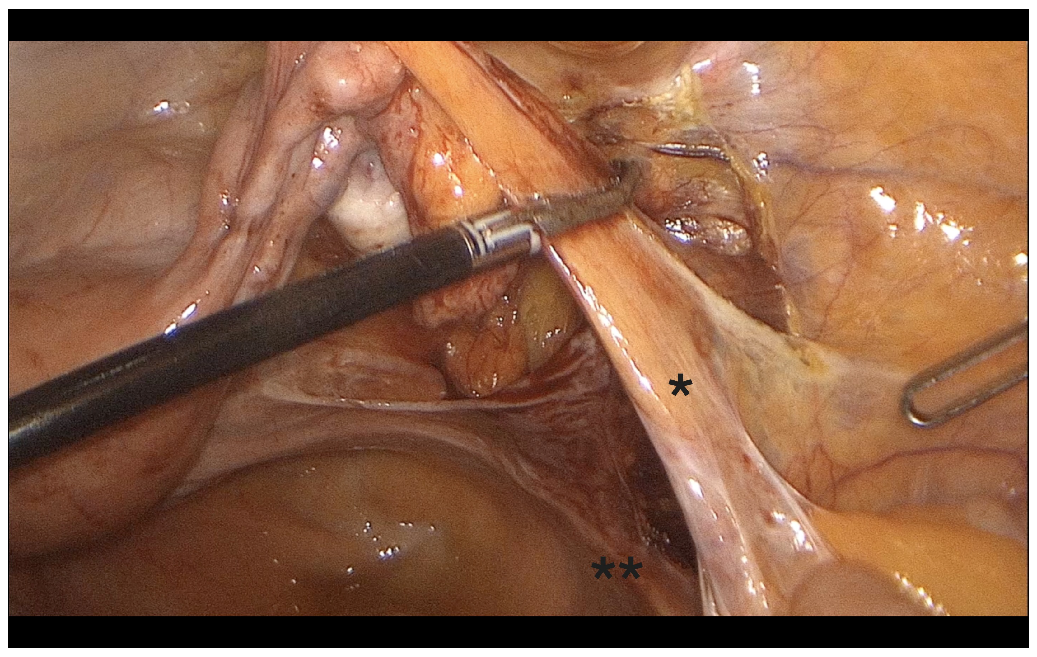 Diagnostics 15 01736 g004