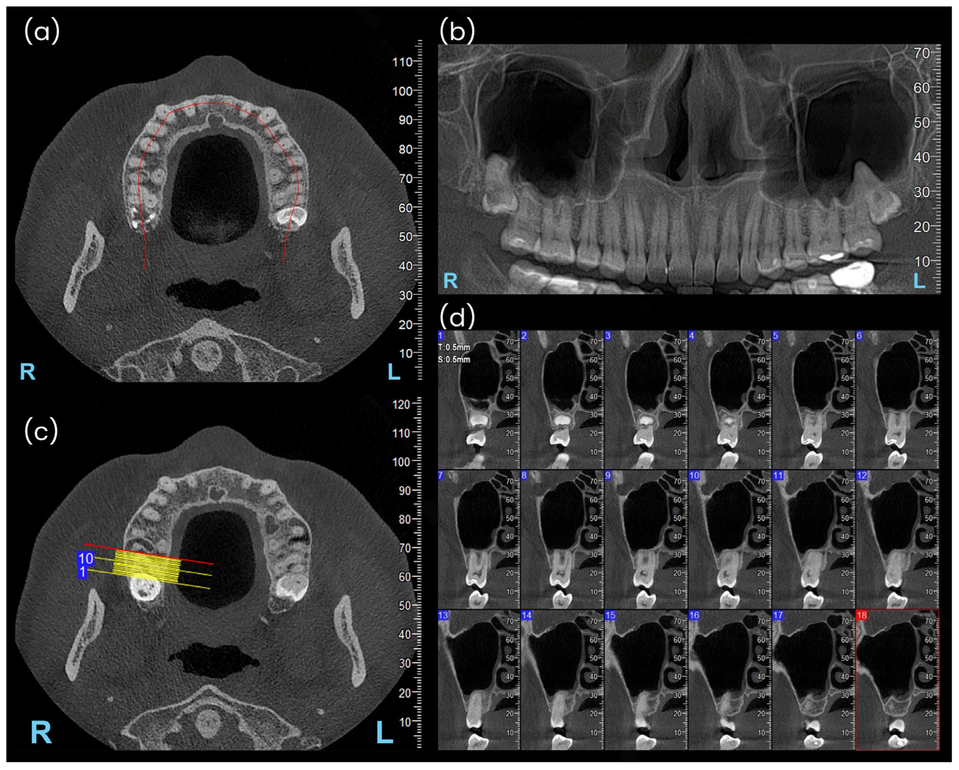 Diagnostics 15 01741 g001
