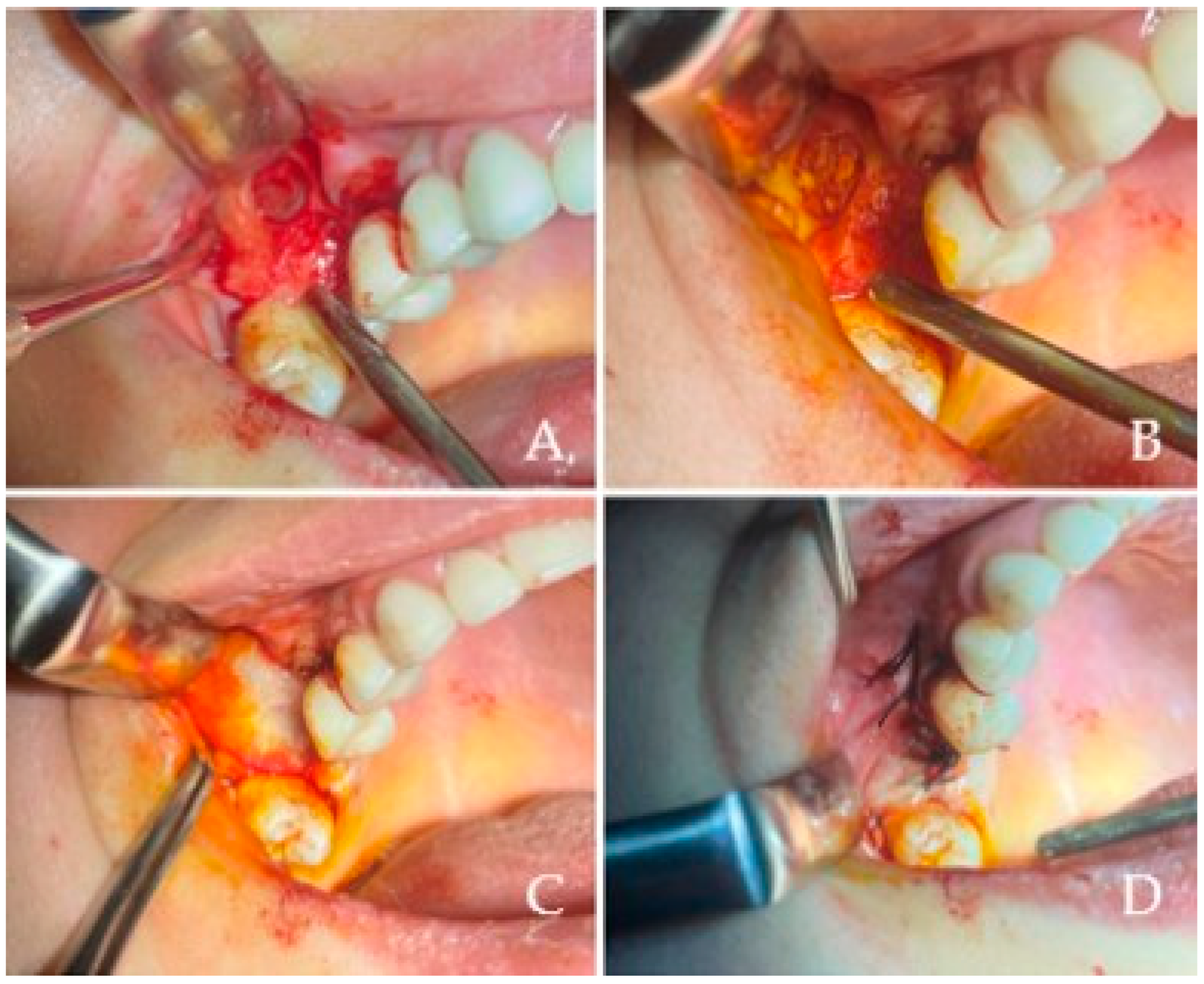 Diagnostics 15 01742 g001