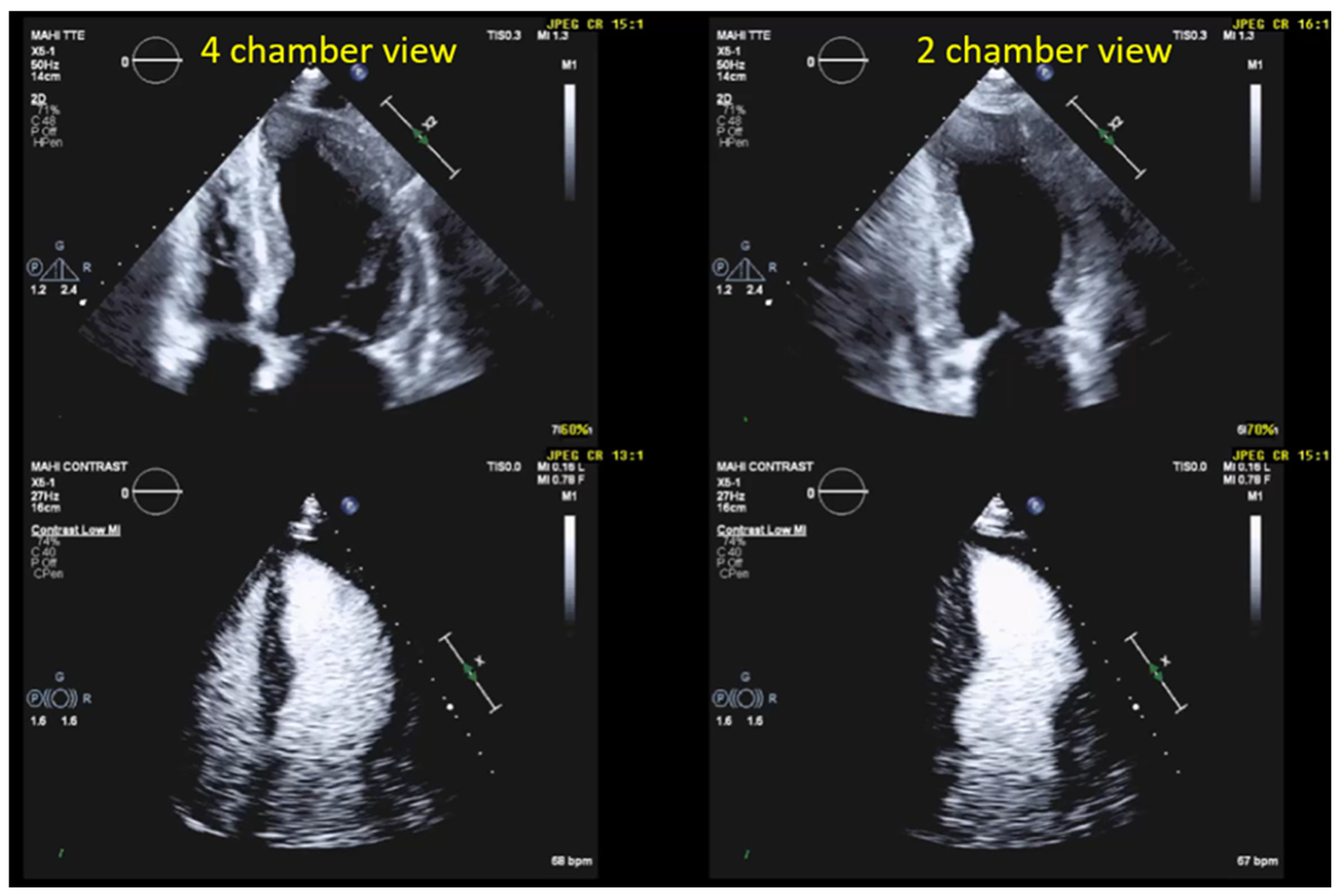 Diagnostics 15 01743 g003 Diagnostics 15 01743 g003