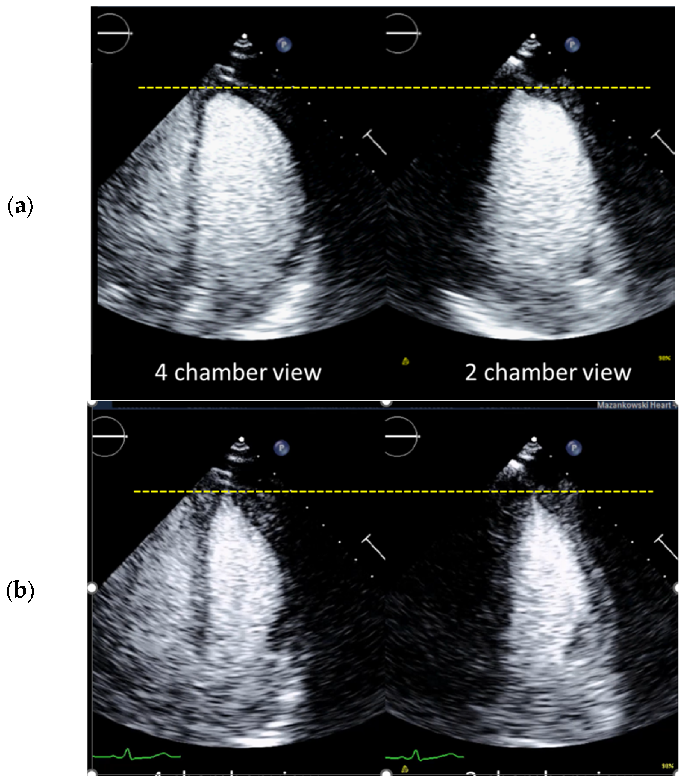Diagnostics 15 01743 g007 Diagnostics 15 01743 g007
