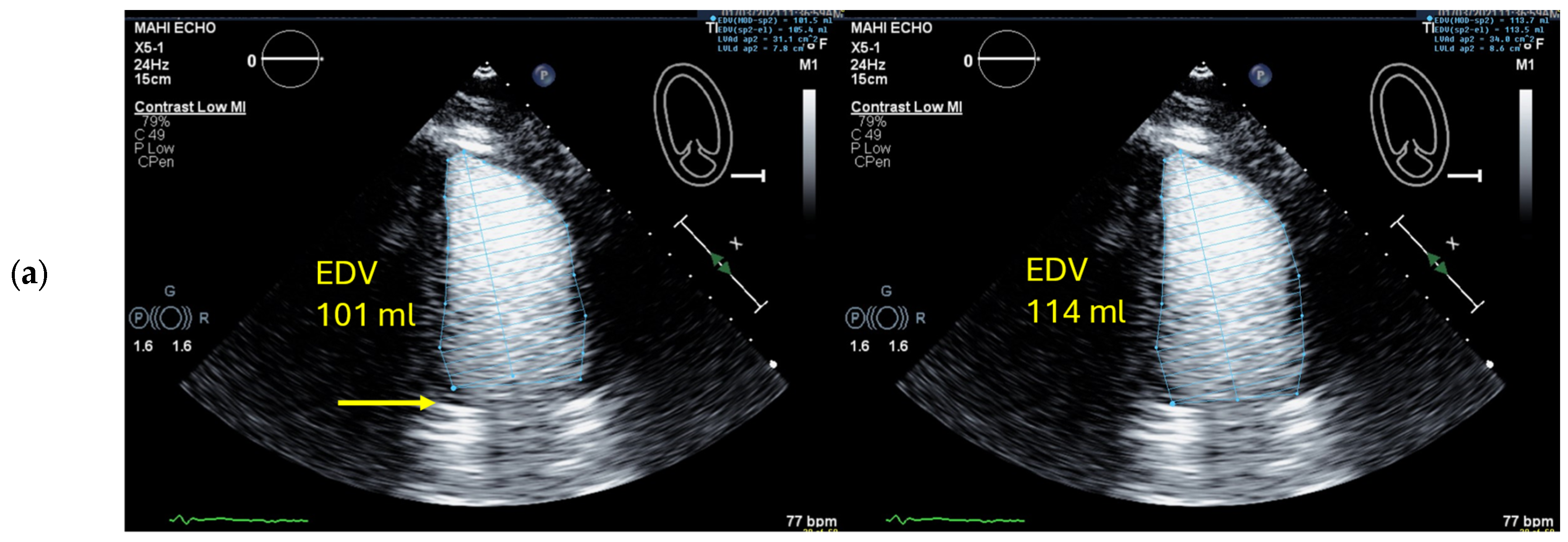 Diagnostics 15 01743 g009a Diagnostics 15 01743 g009a