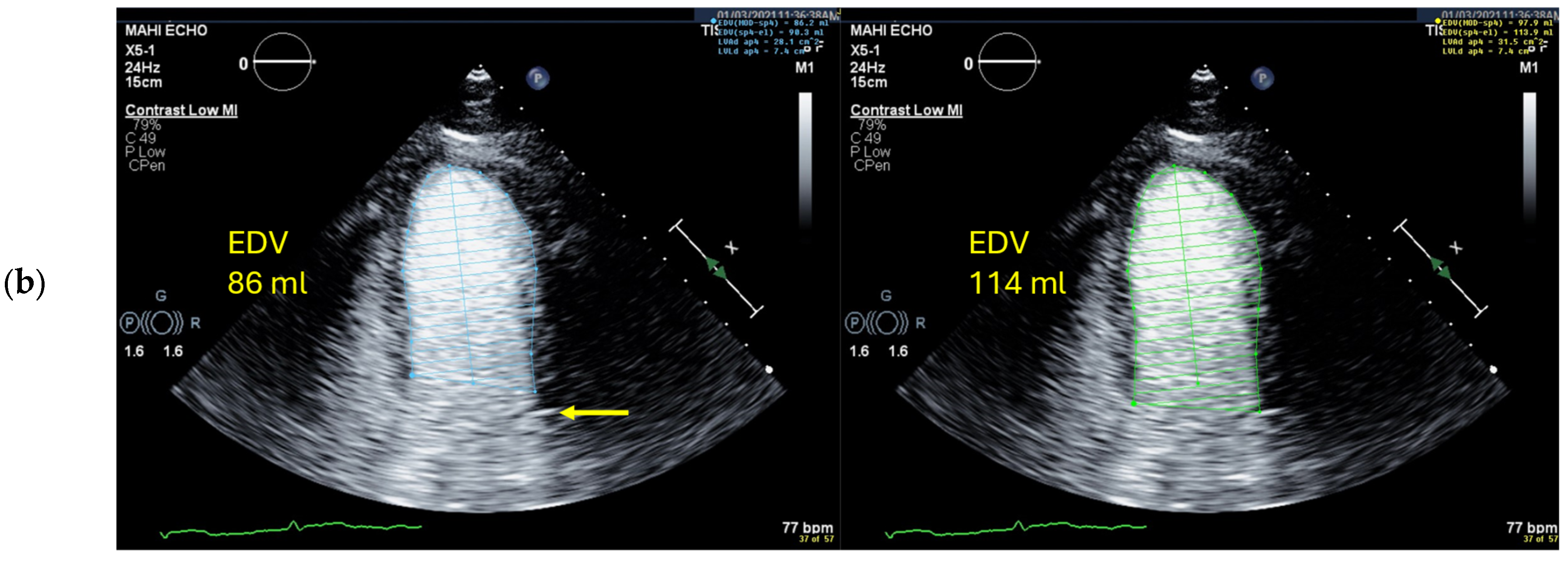 Diagnostics 15 01743 g009b Diagnostics 15 01743 g009b
