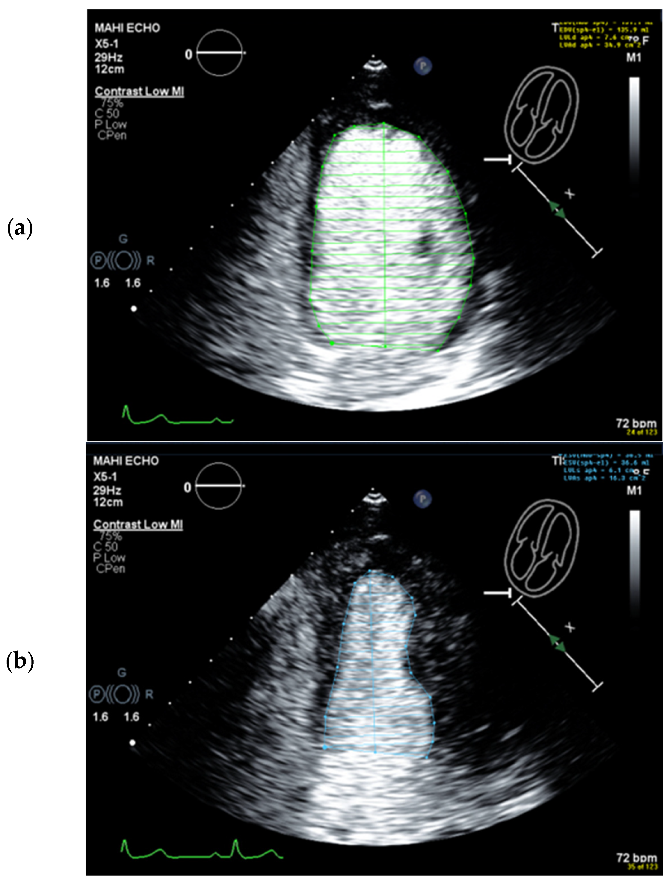 Diagnostics 15 01743 g010a Diagnostics 15 01743 g010a