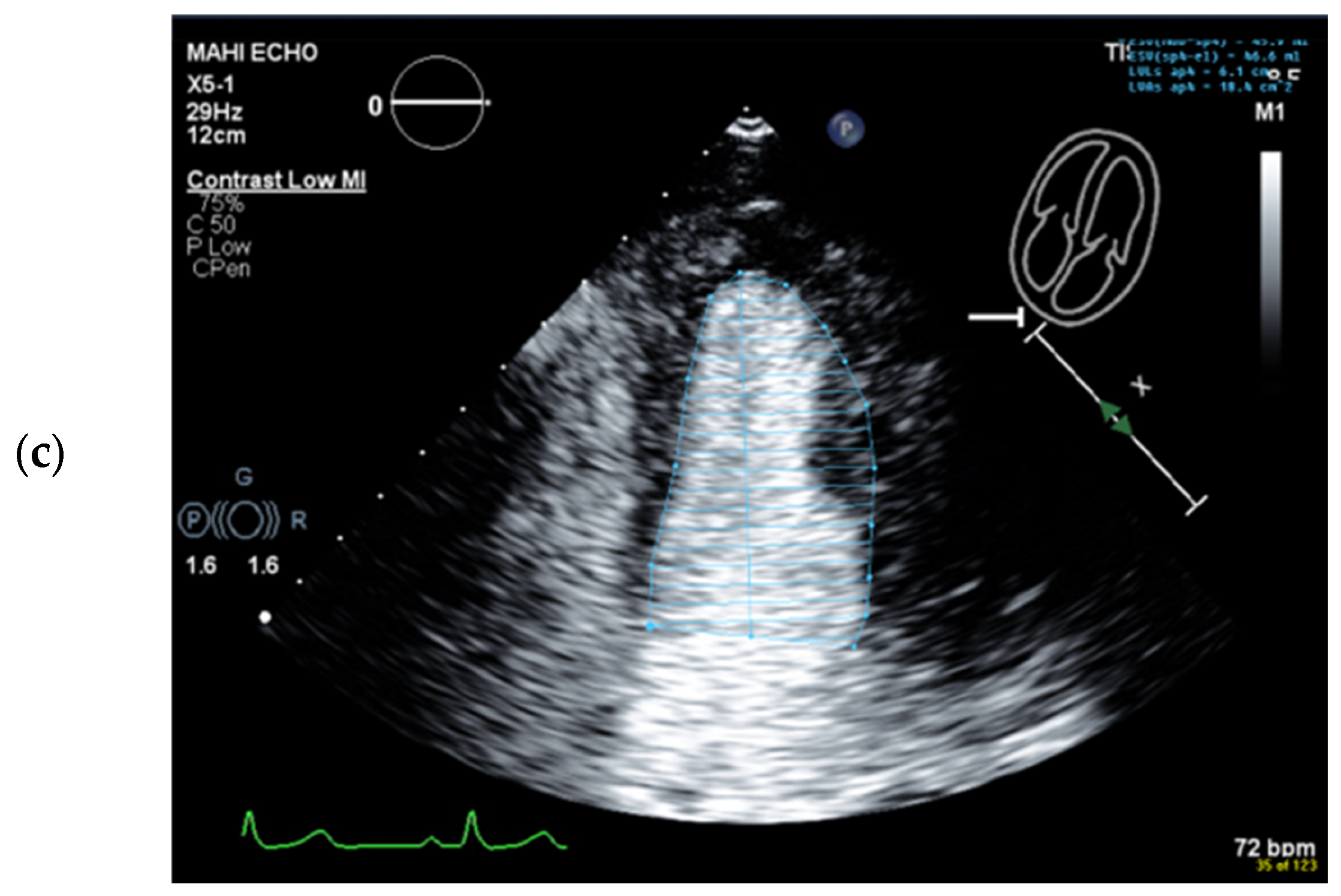 Diagnostics 15 01743 g010b Diagnostics 15 01743 g010b